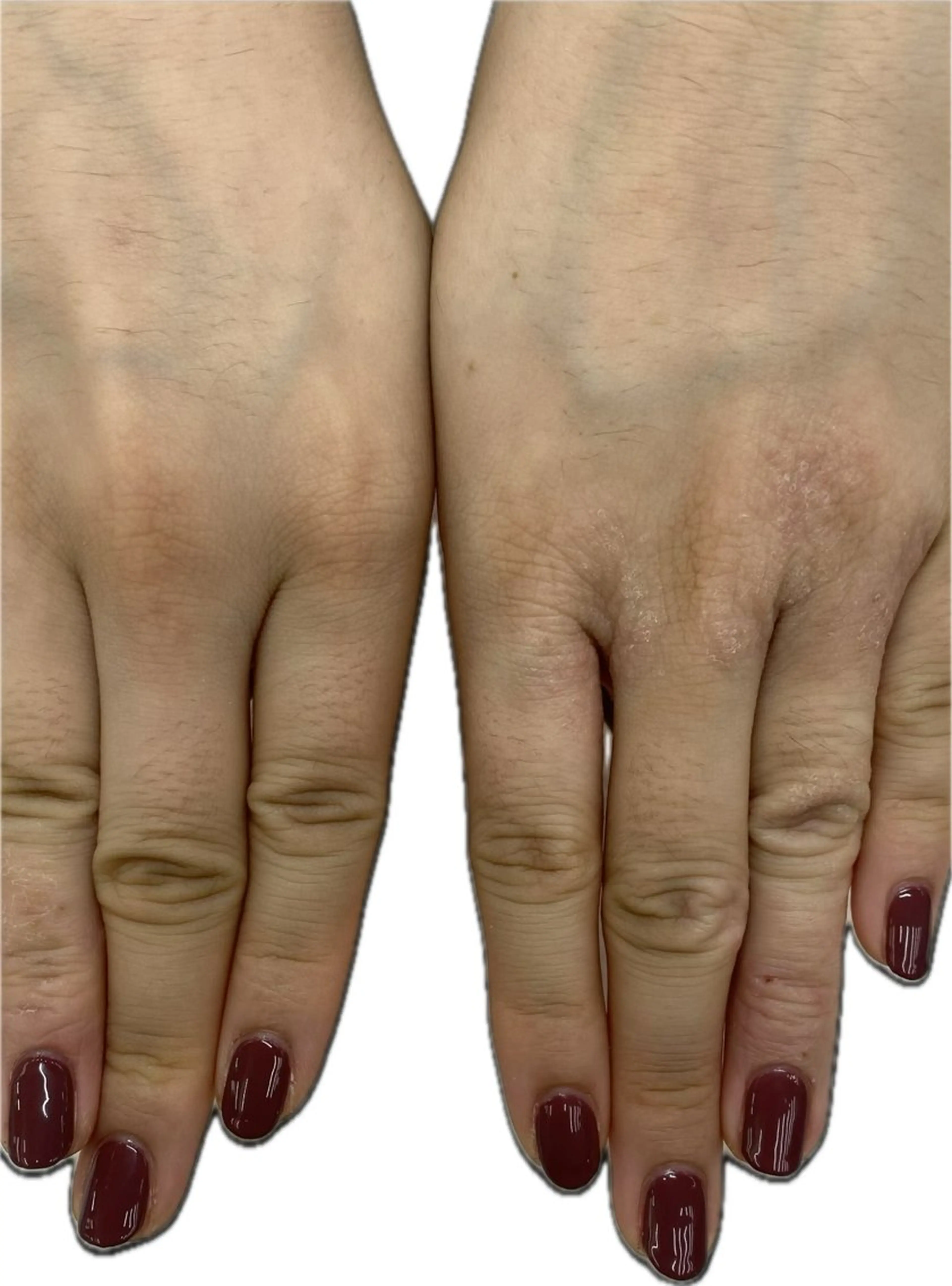 ネイル MAXKELLY AIのネイルデザイン