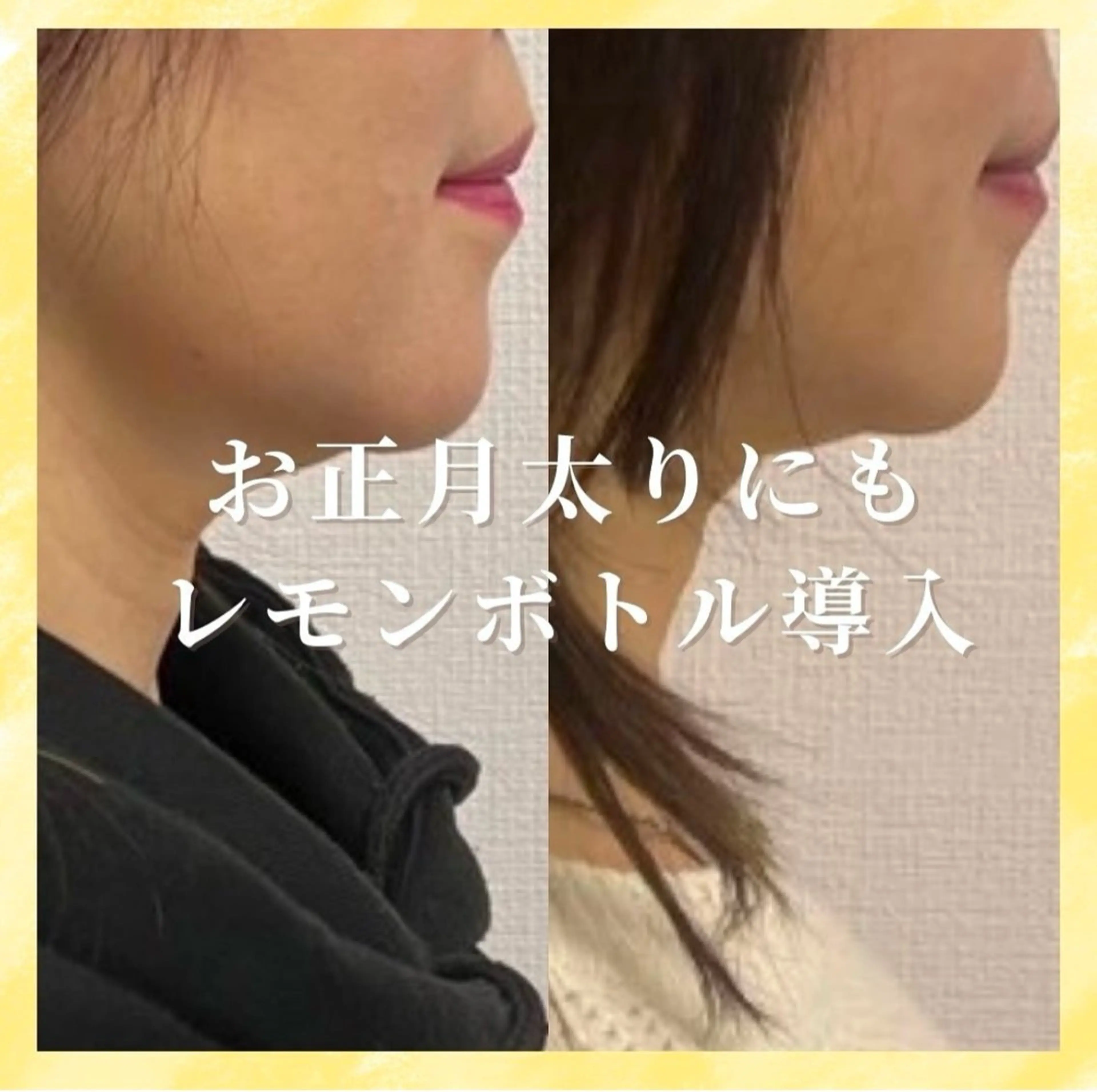 エステ 看護師が施術する小顔 サロン/KIKIのエステ・リラクイメージ