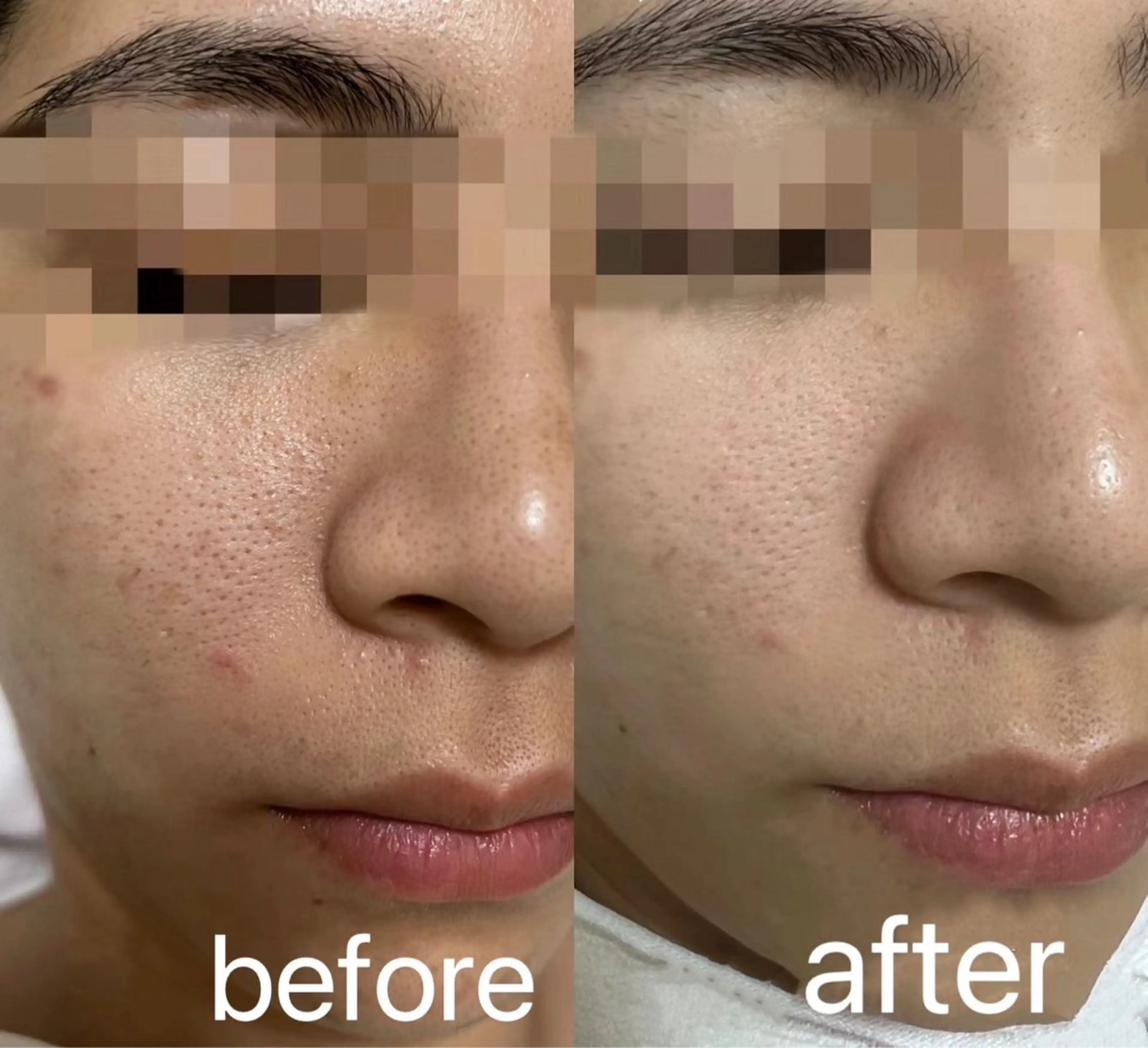 エステ エステサロン lindyのエステ・リラクイメージ