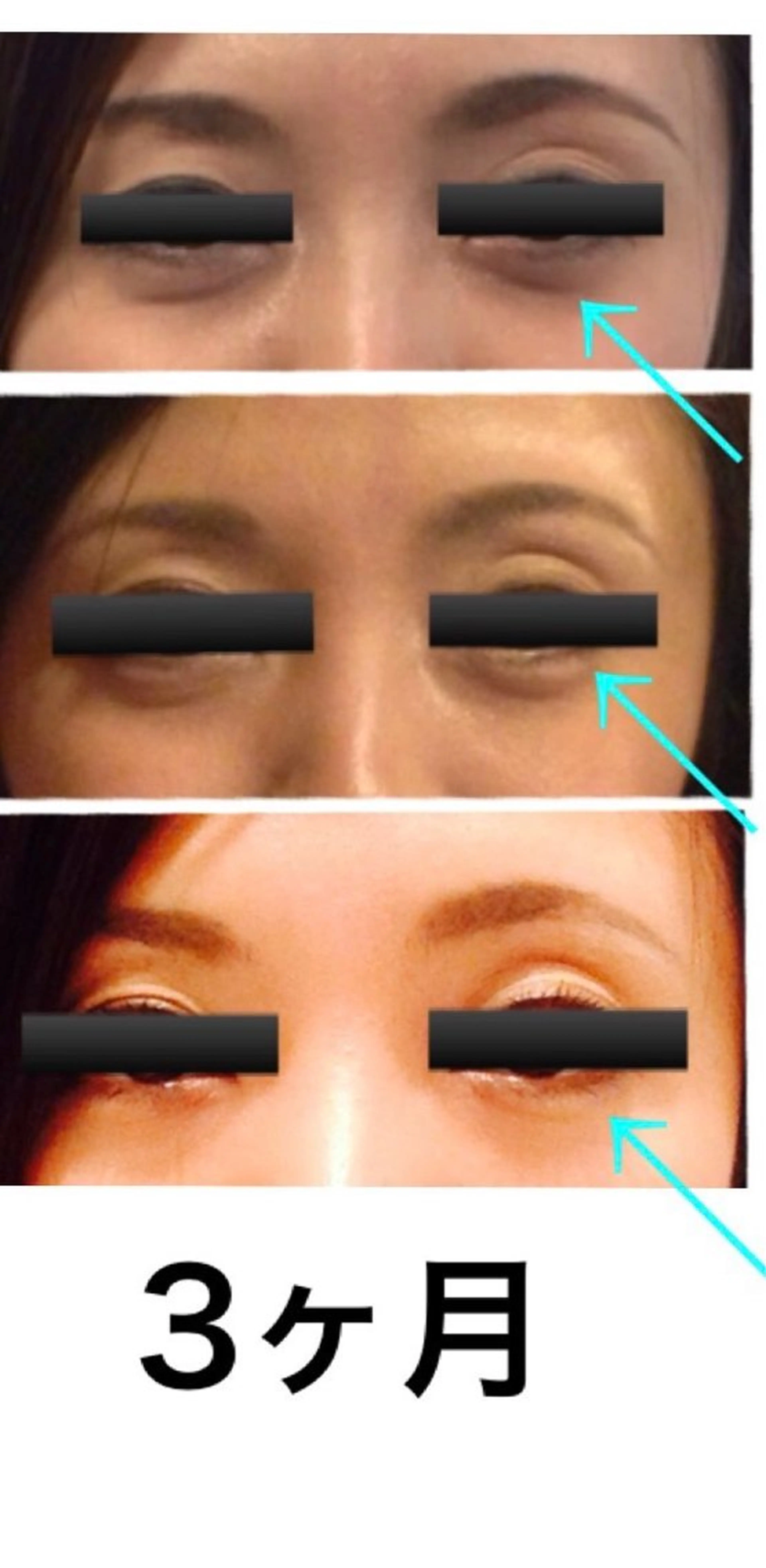 肌質を変えて すっぴん肌に✨のその他イメージ