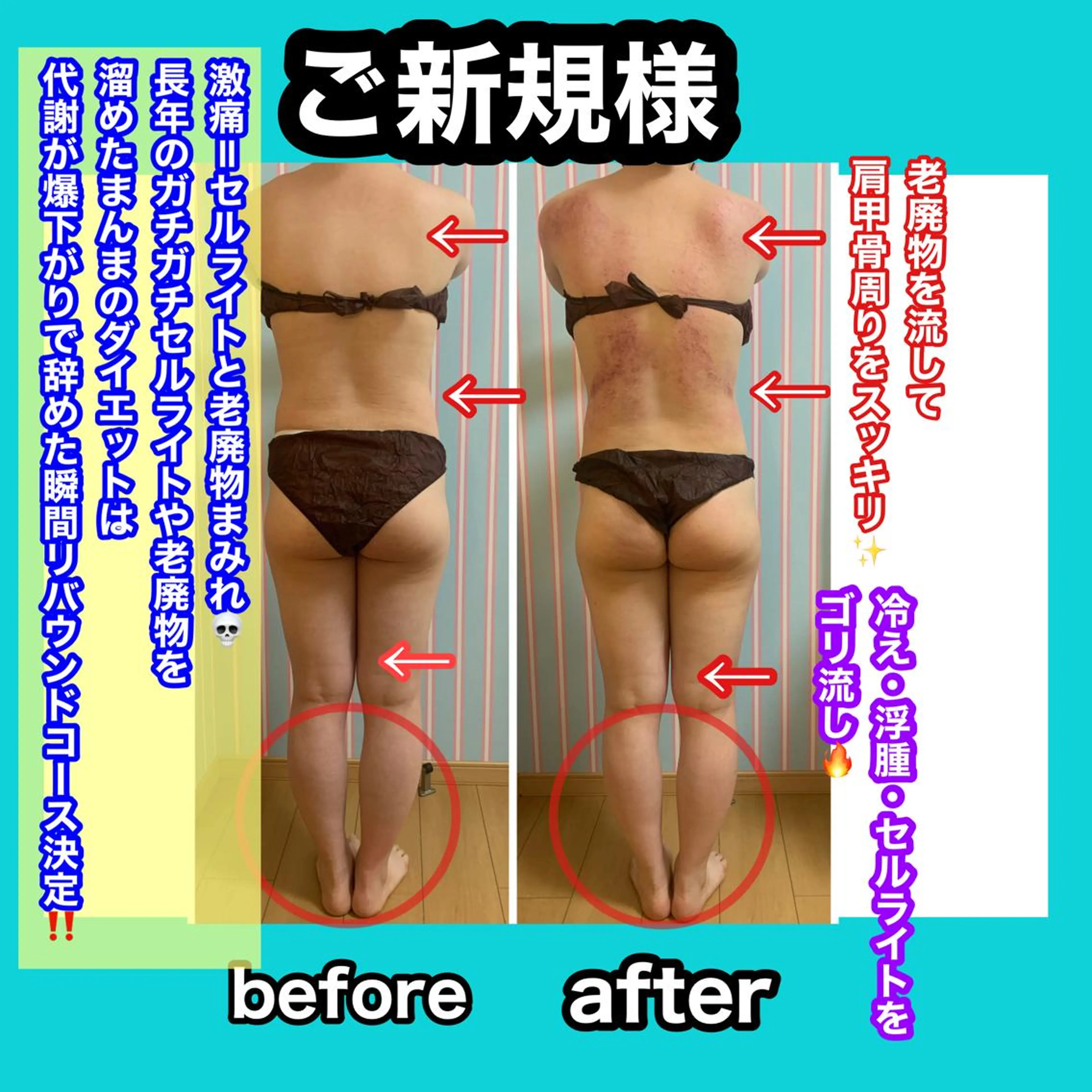 エステ リラク 痩身/脱毛/ネイル HARUKAのエステ・リラクイメージ