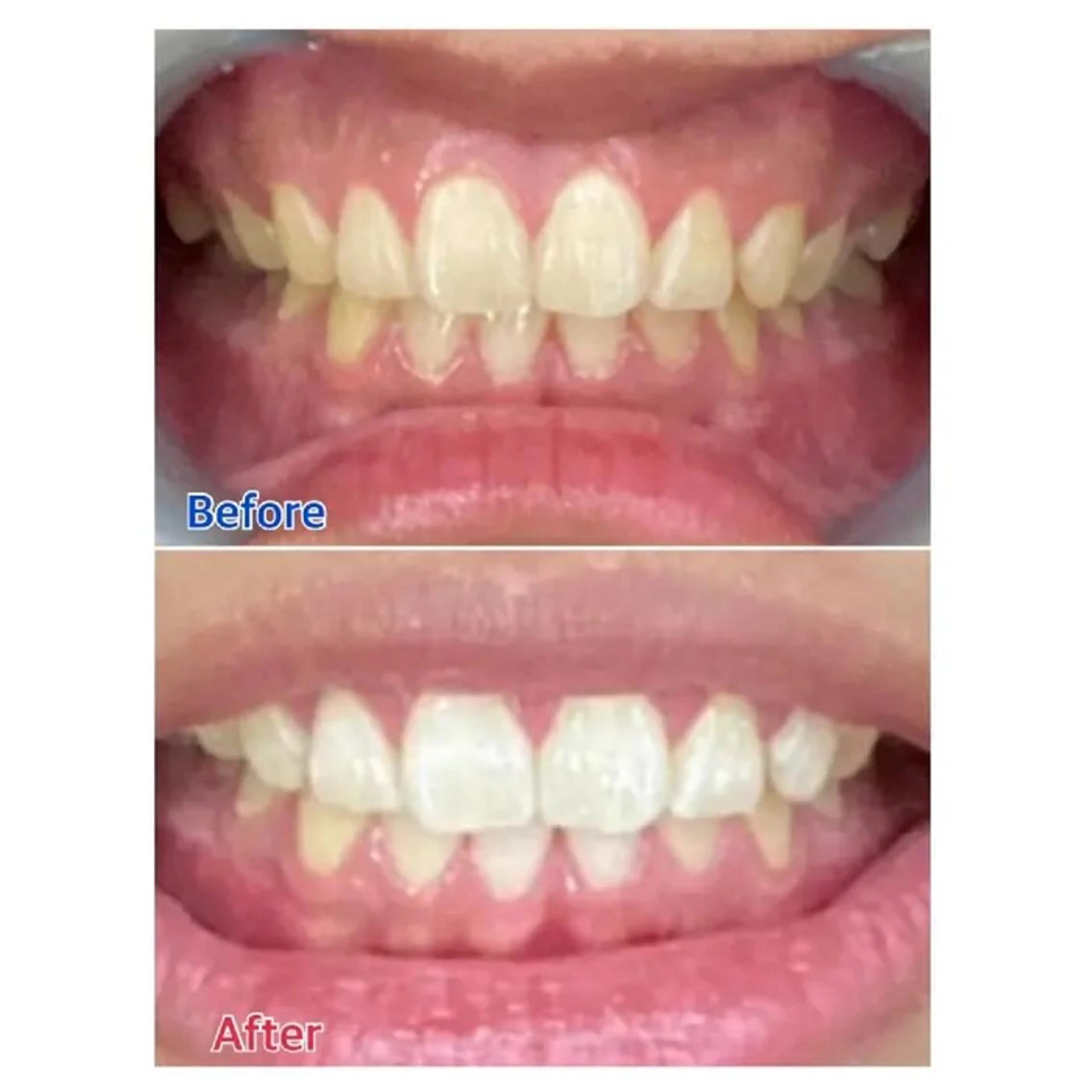 M渋谷 ホワイトニングのエステ・リラクイメージ