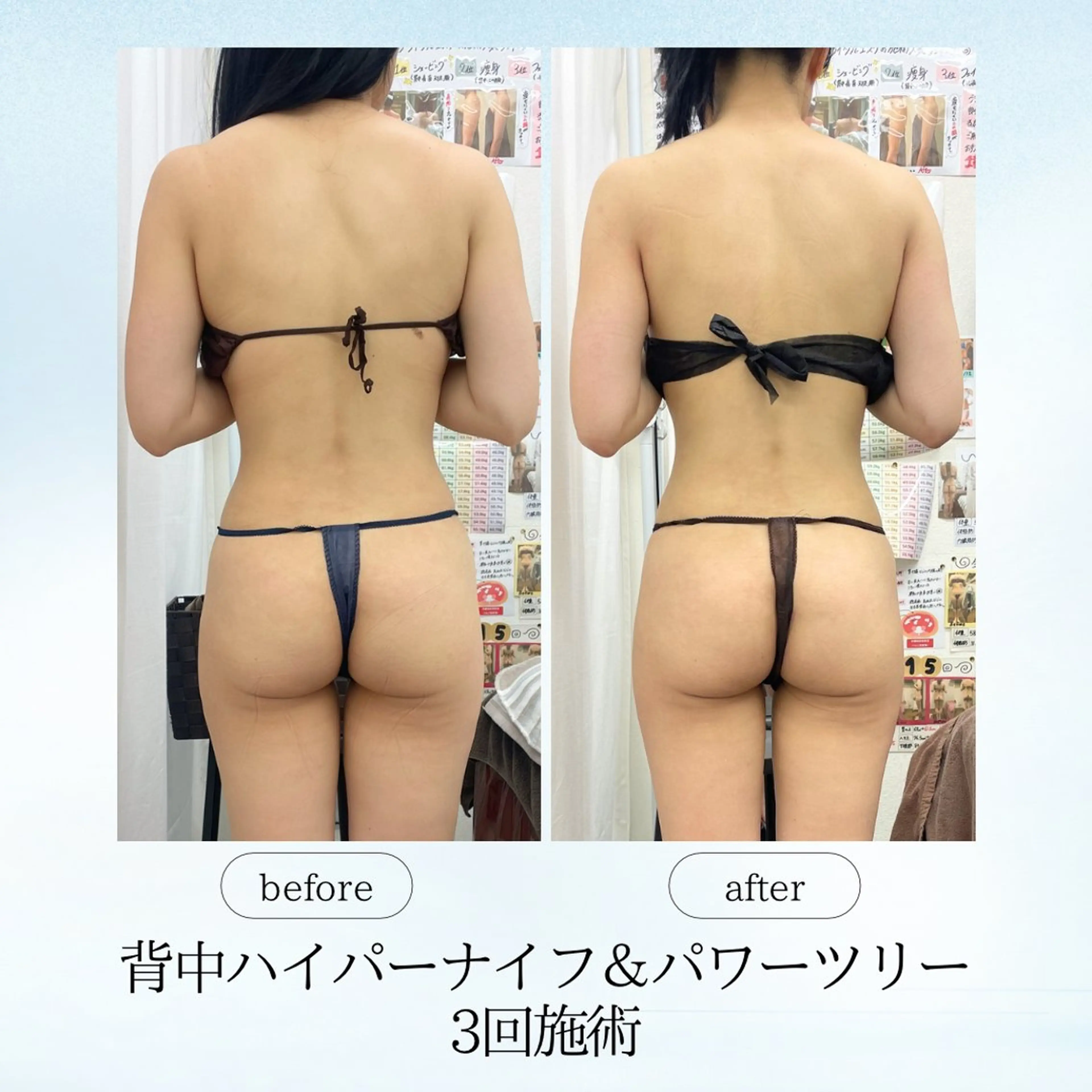 エステ リラク espresso,所属・《痩身、小顔専門店》 エスプレッソのエステ・リラクイメージ