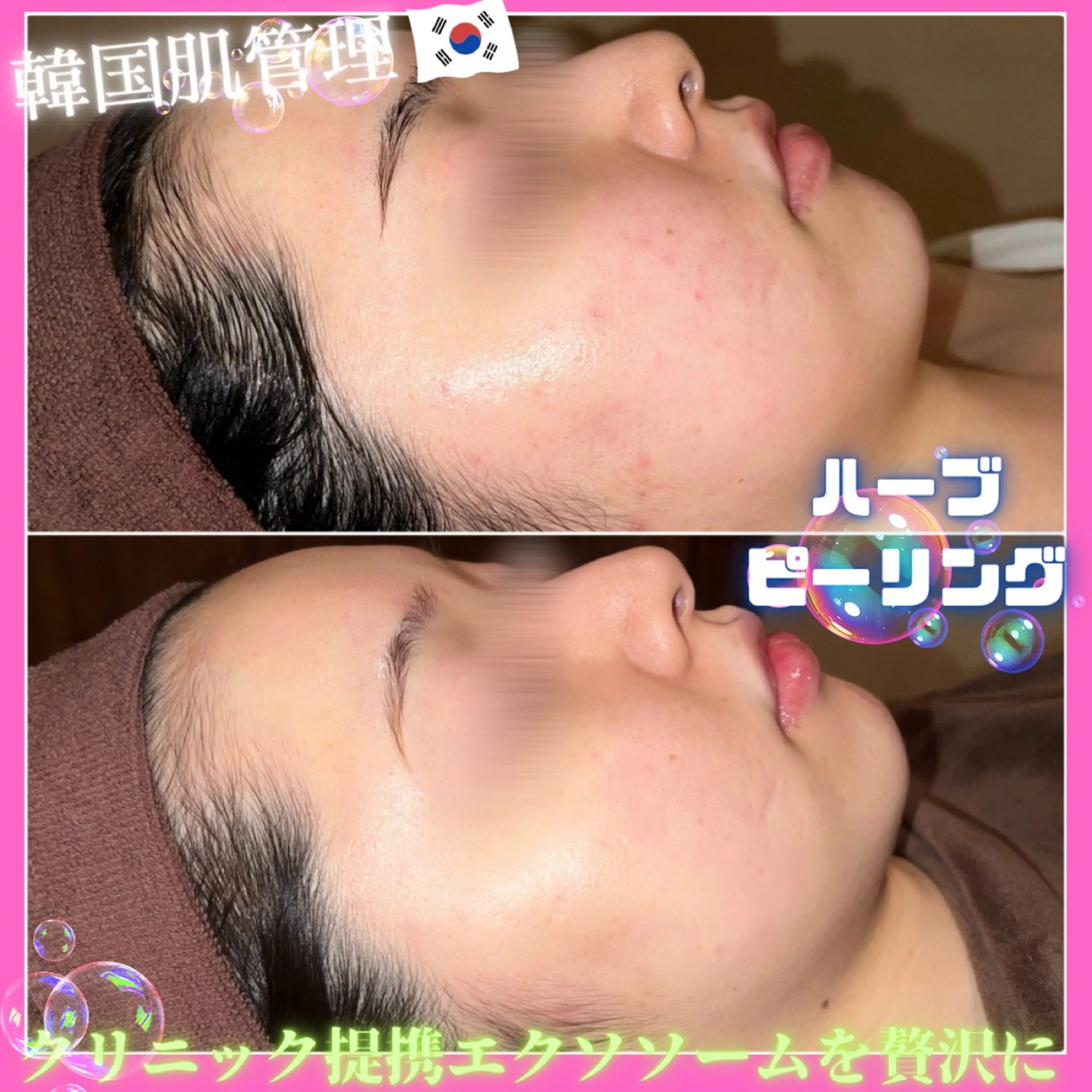 エステ リラク 痩身&美肌サロン 堀米✨のその他イメージ