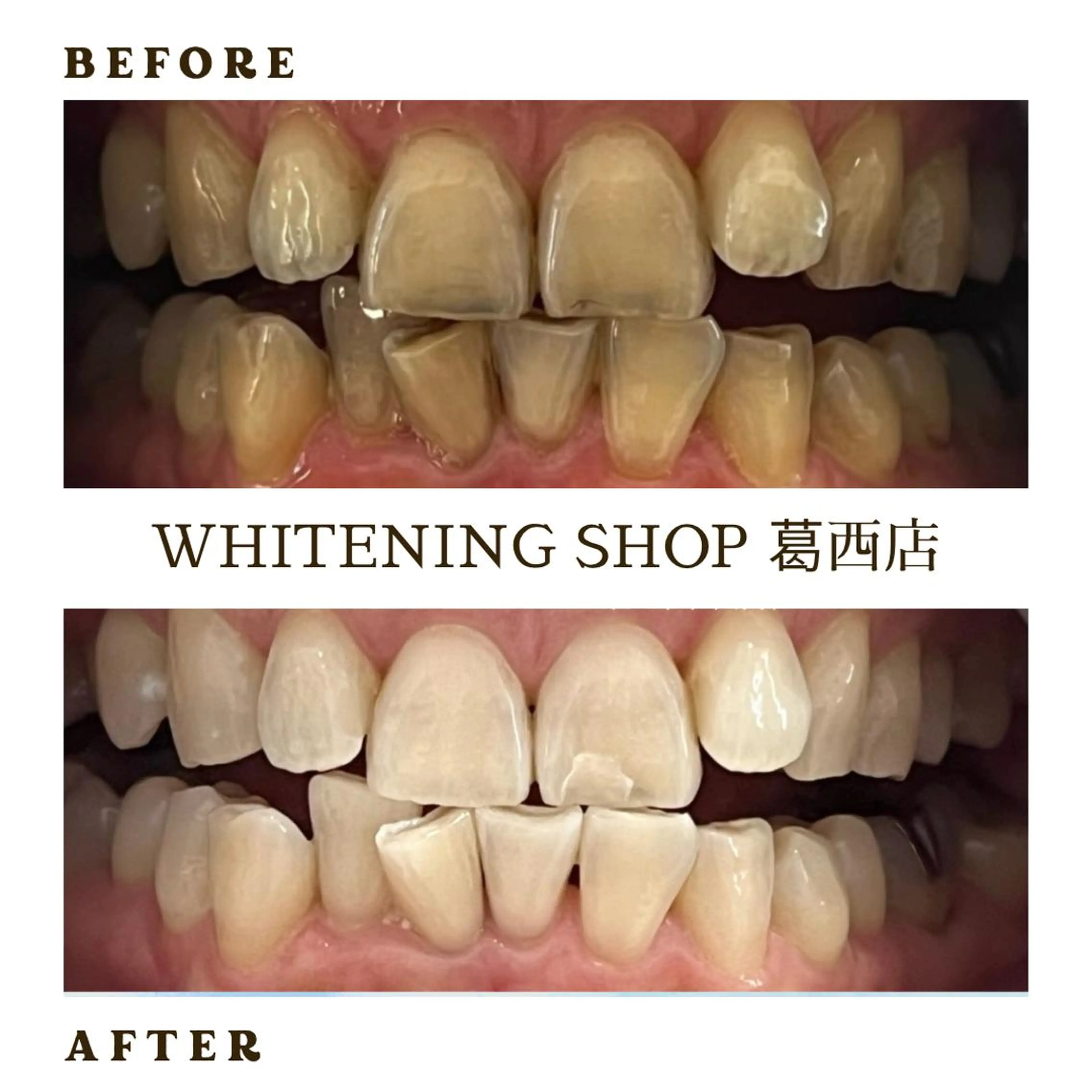 メンズ その他 ホワイトニング ショップ葛西店のその他イメージ