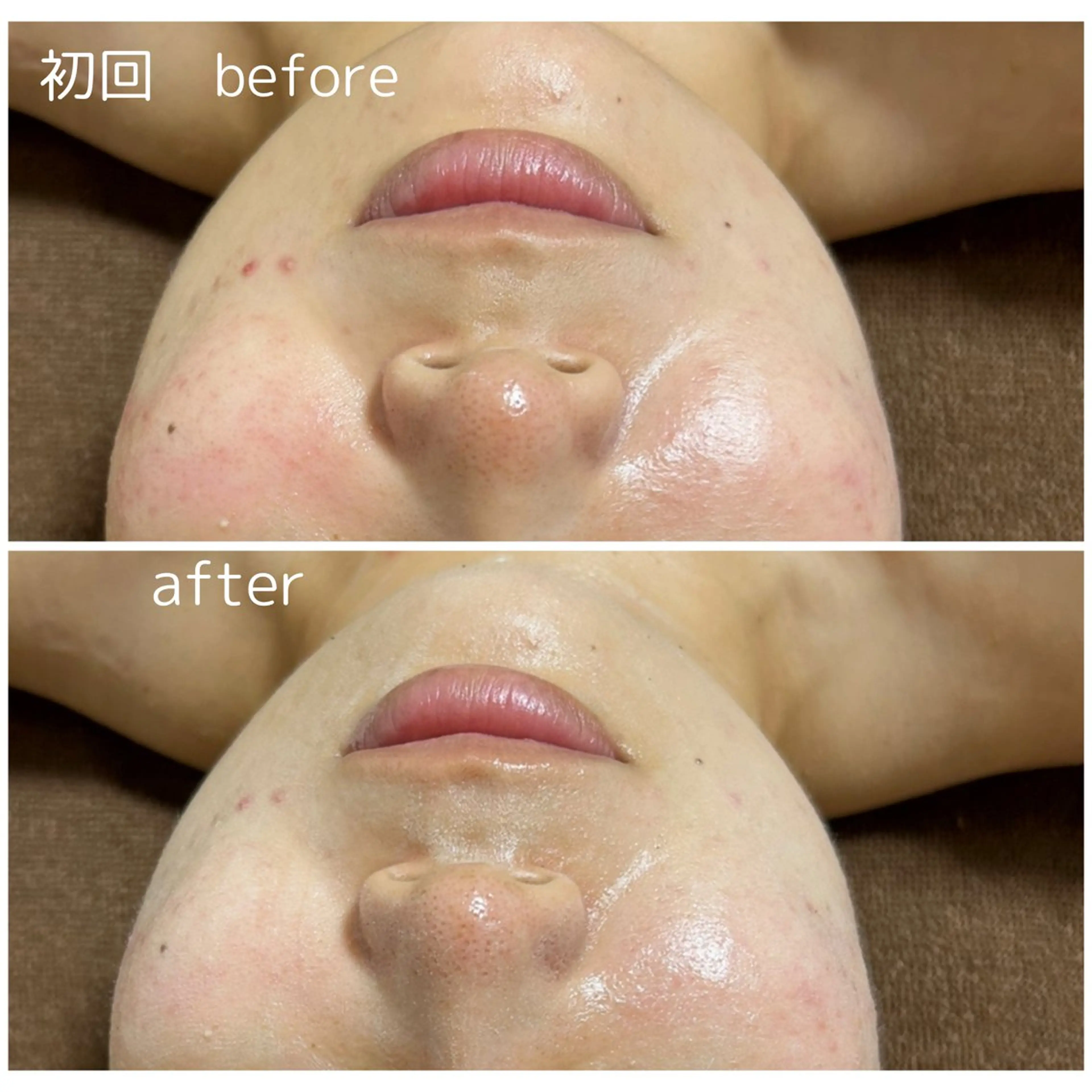 エステ 永田 利佳子のその他イメージ