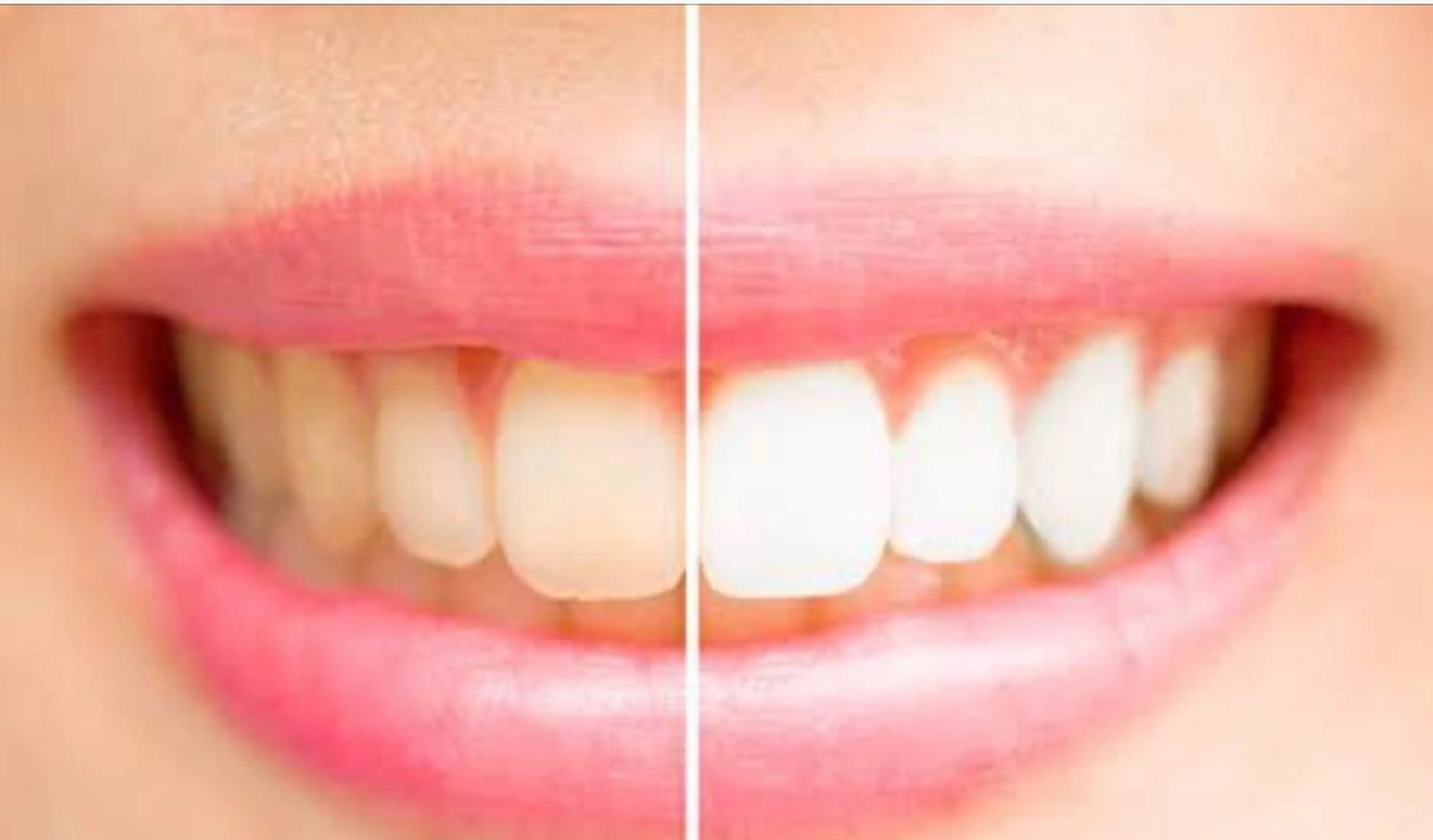 エステ バストアップサロン 「パトラクシェ本店」のエステ・リラクイメージ