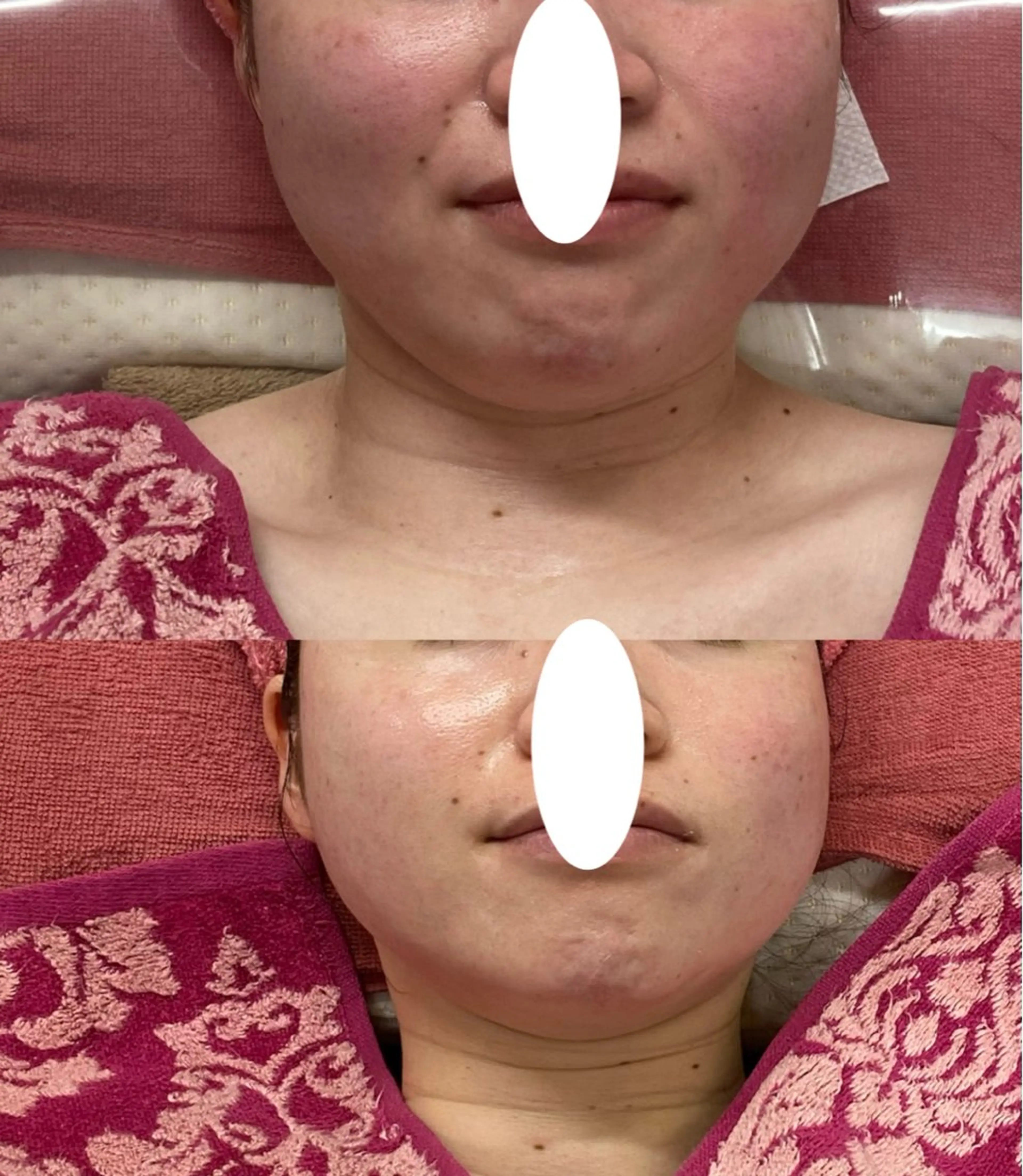 小顔・ニキビ ・脱毛サロンのエステ・リラクイメージ