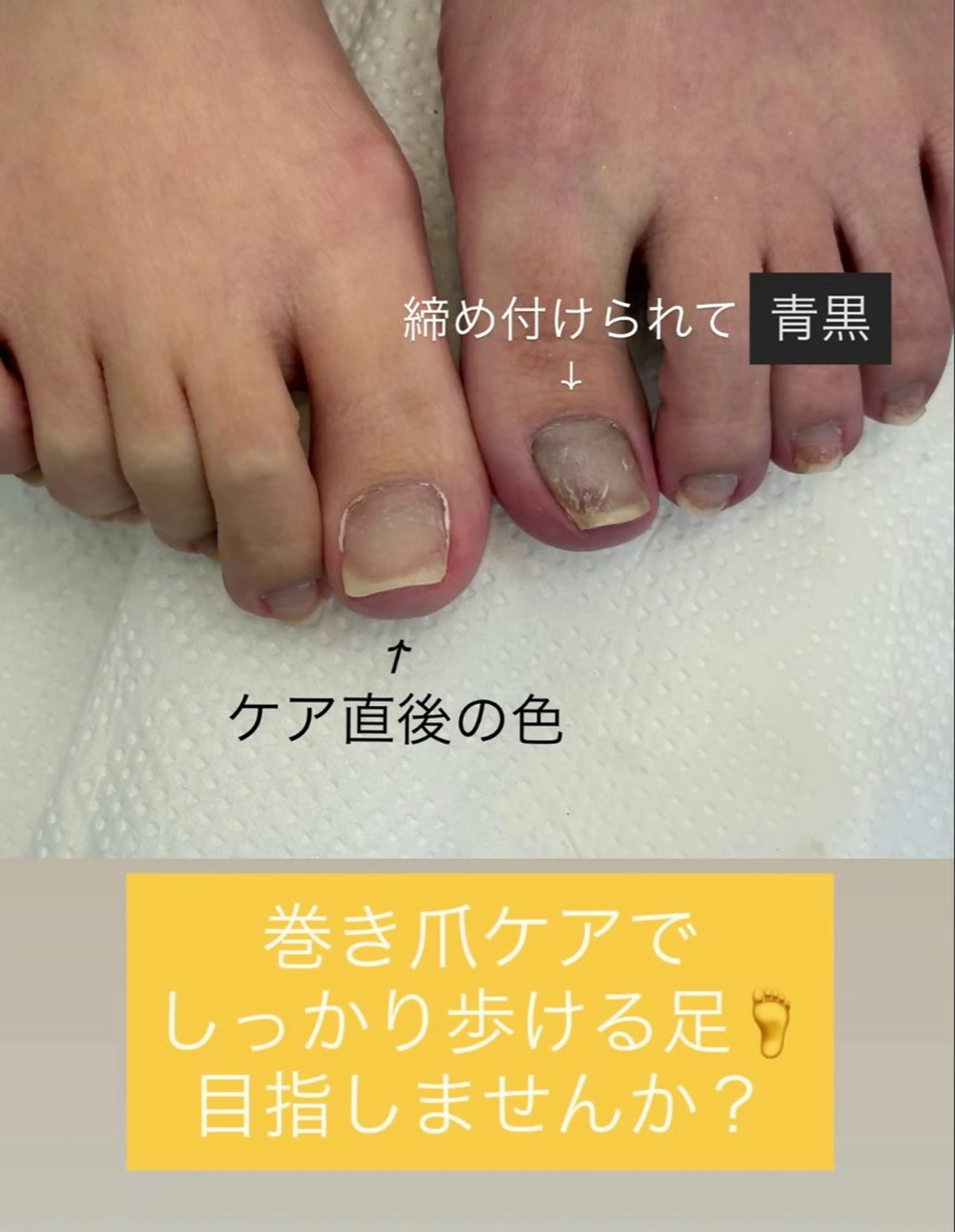 ネイル その他(ネイル) 永田 有美のネイルデザイン