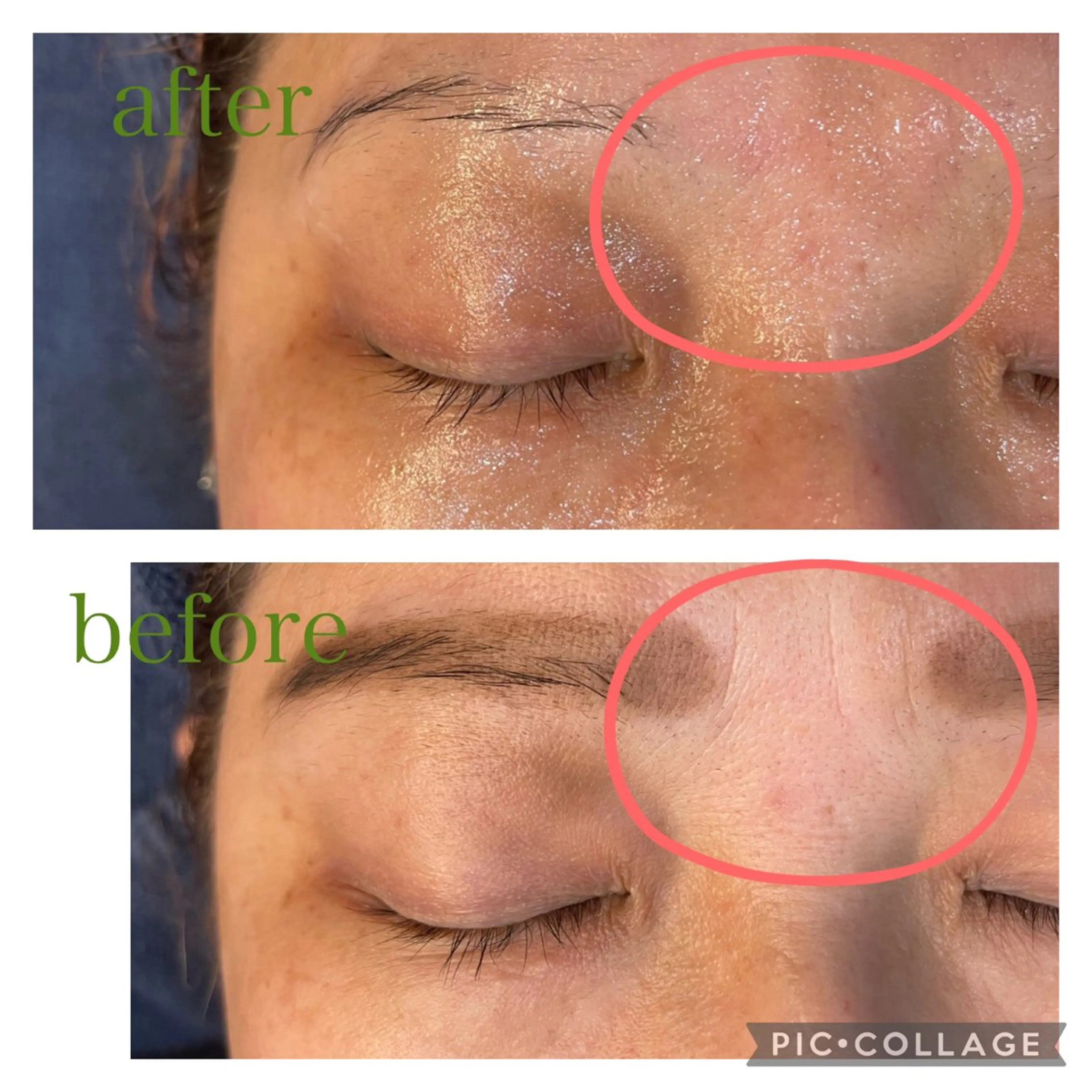 leolo武蔵浦和 肌質改善＆脱毛のエステ・リラクイメージ