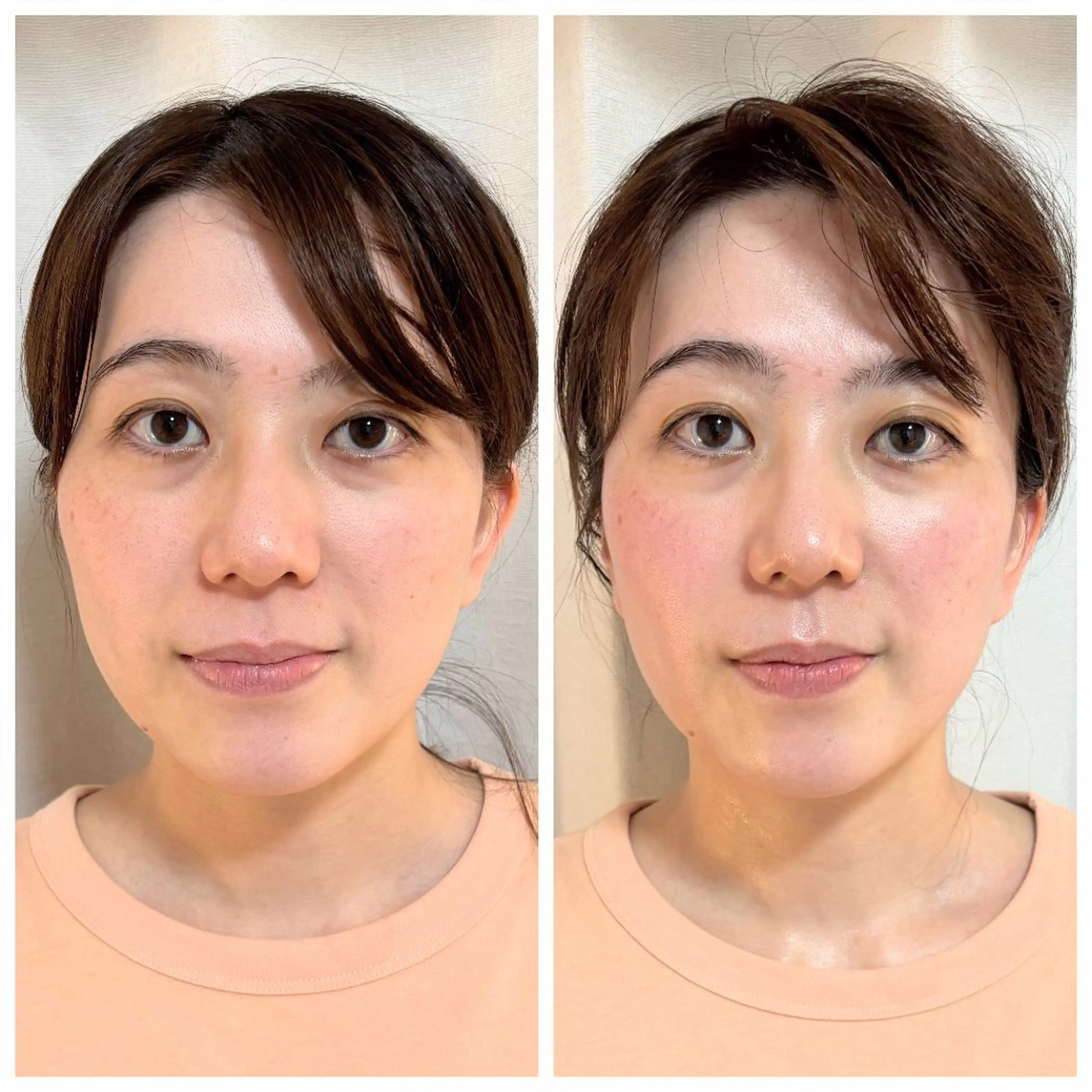 LaLa所属・小顔・たるみケア 専門店【LaLa】のエステ・リラクイメージ