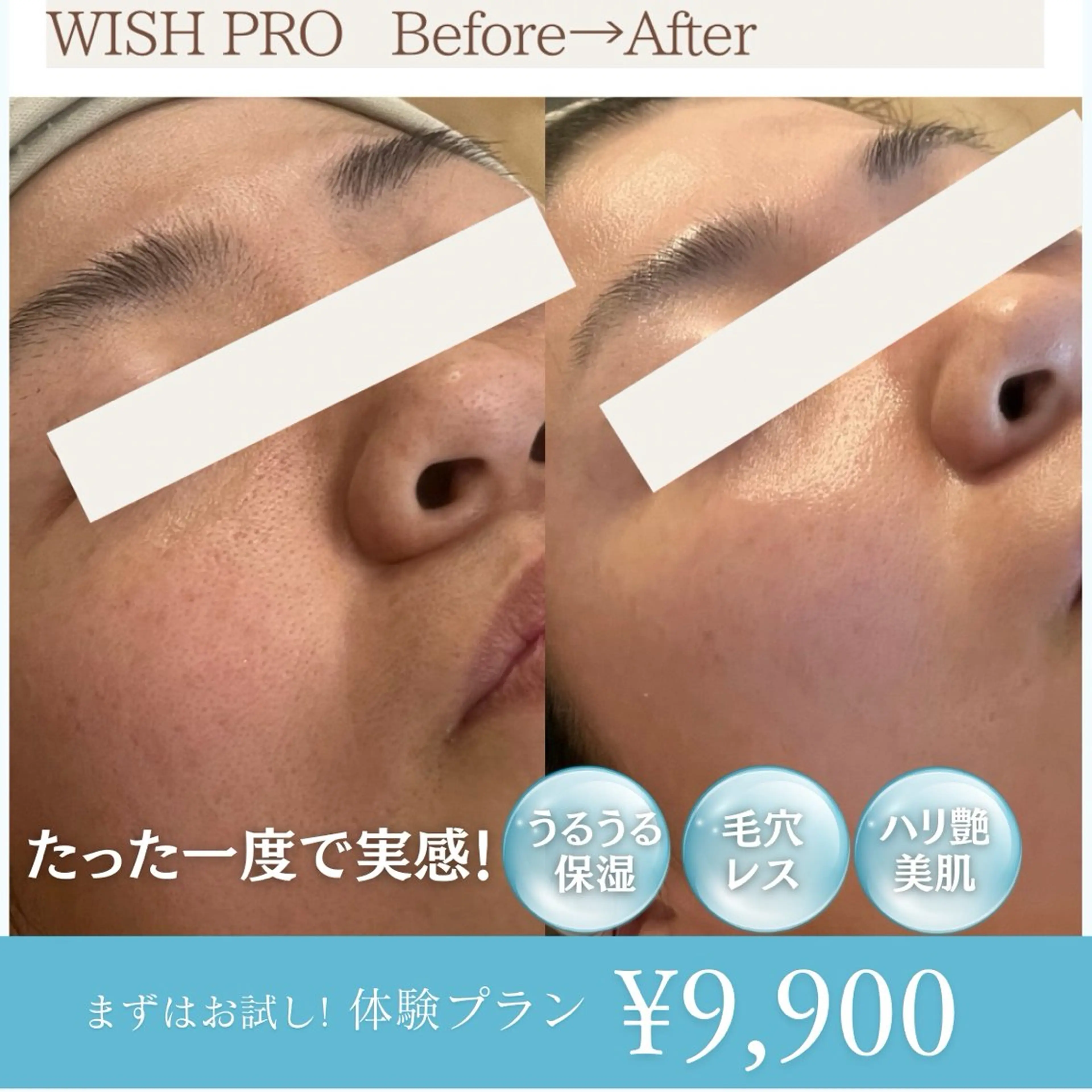 エステ 脱毛専門 ページ/Bloomのエステ・リラクイメージ