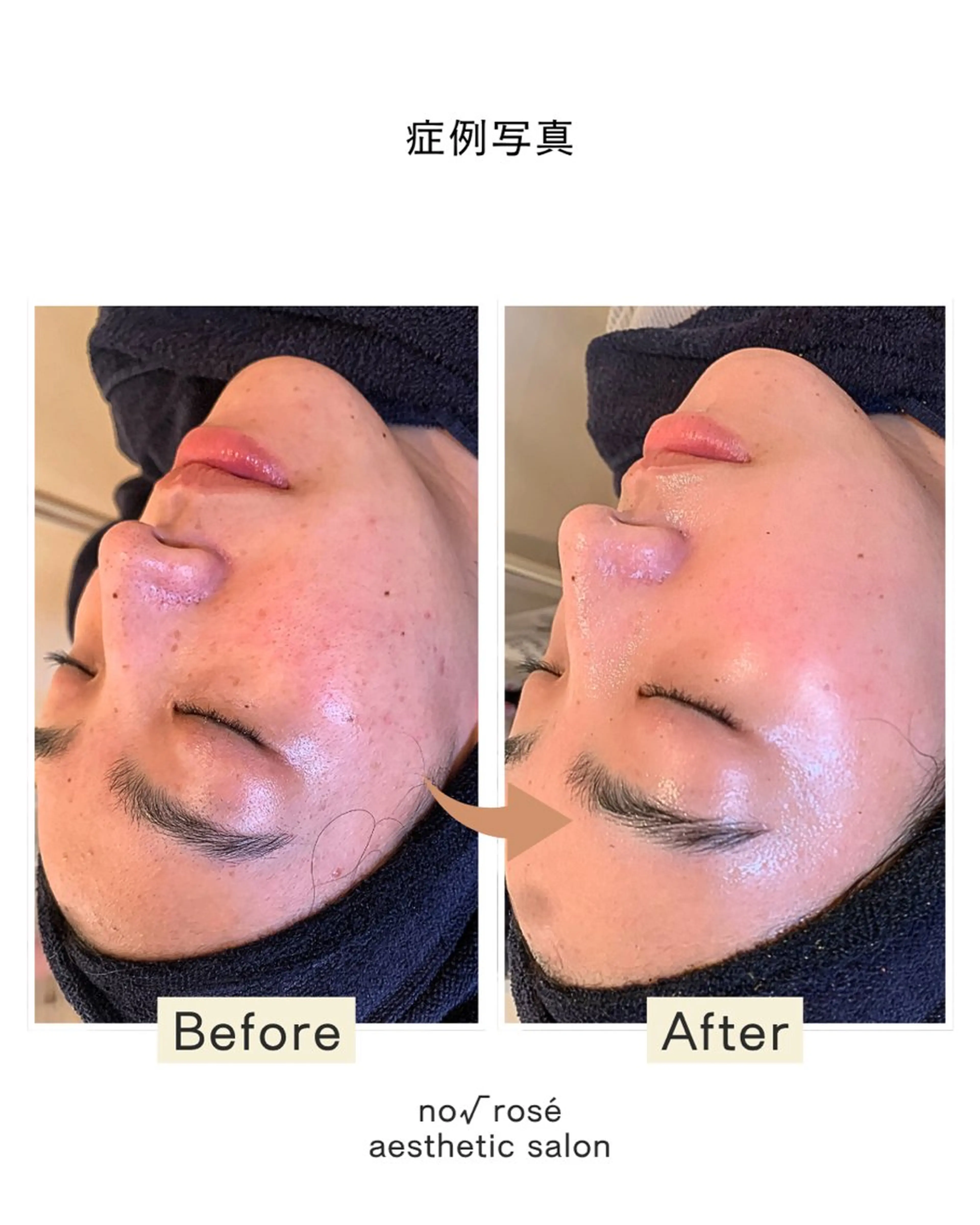 エステ ノールート ロゼのエステ・リラクイメージ