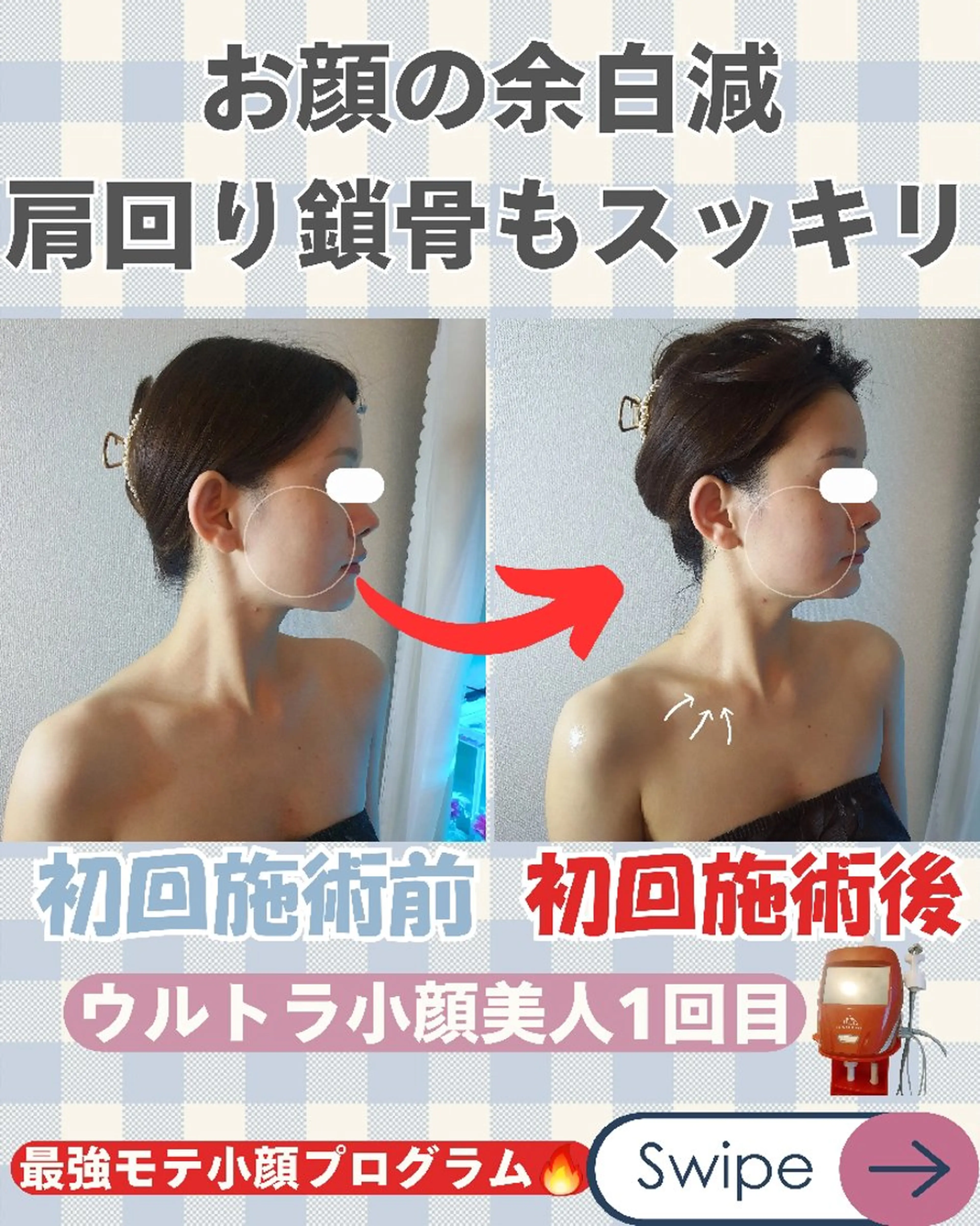 痩身ハーブピーリング 筋膜リリース☆B&Hのエステ・リラクイメージ