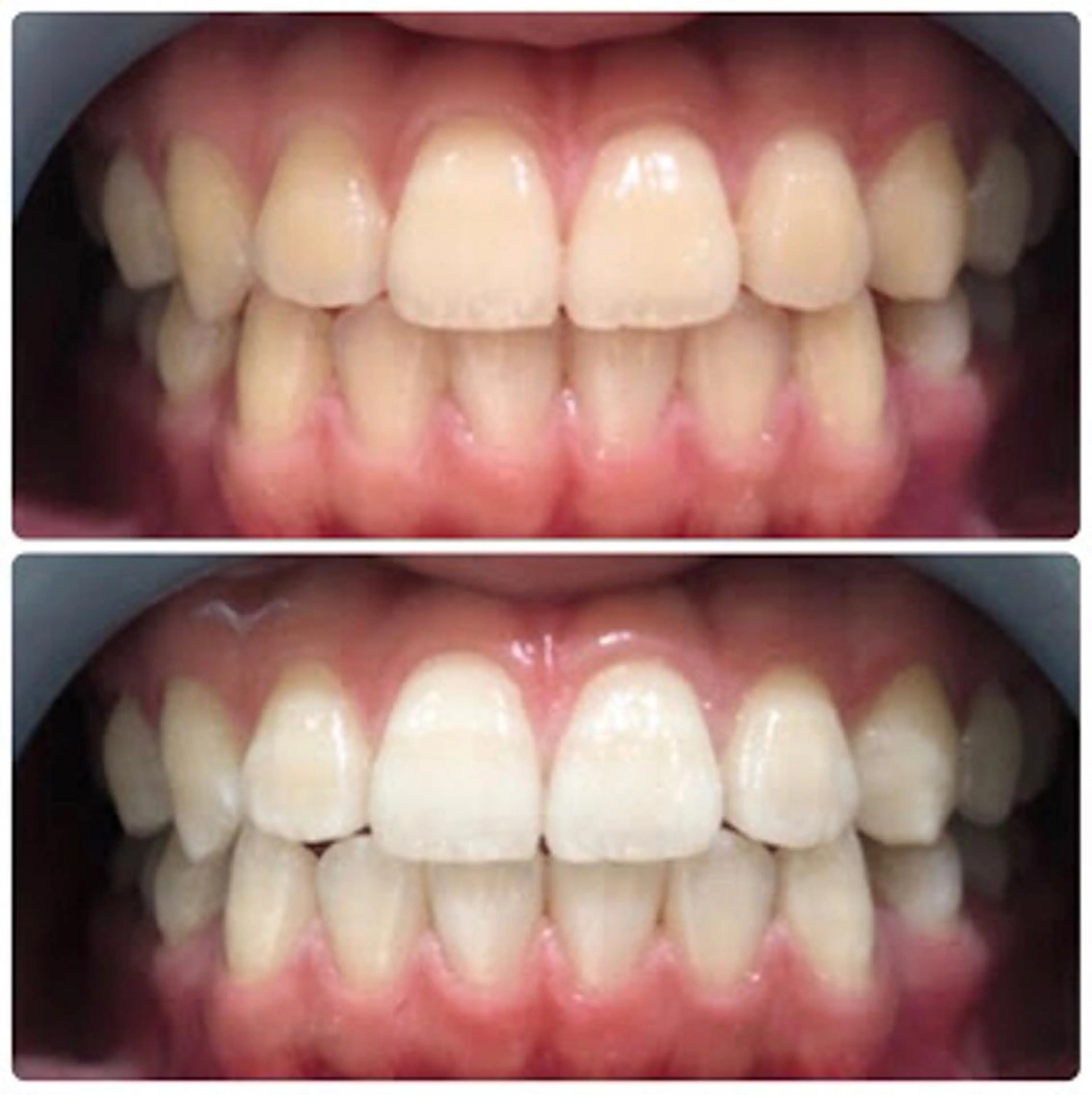 脱毛サロン ファインアートのエステ・リラクイメージ