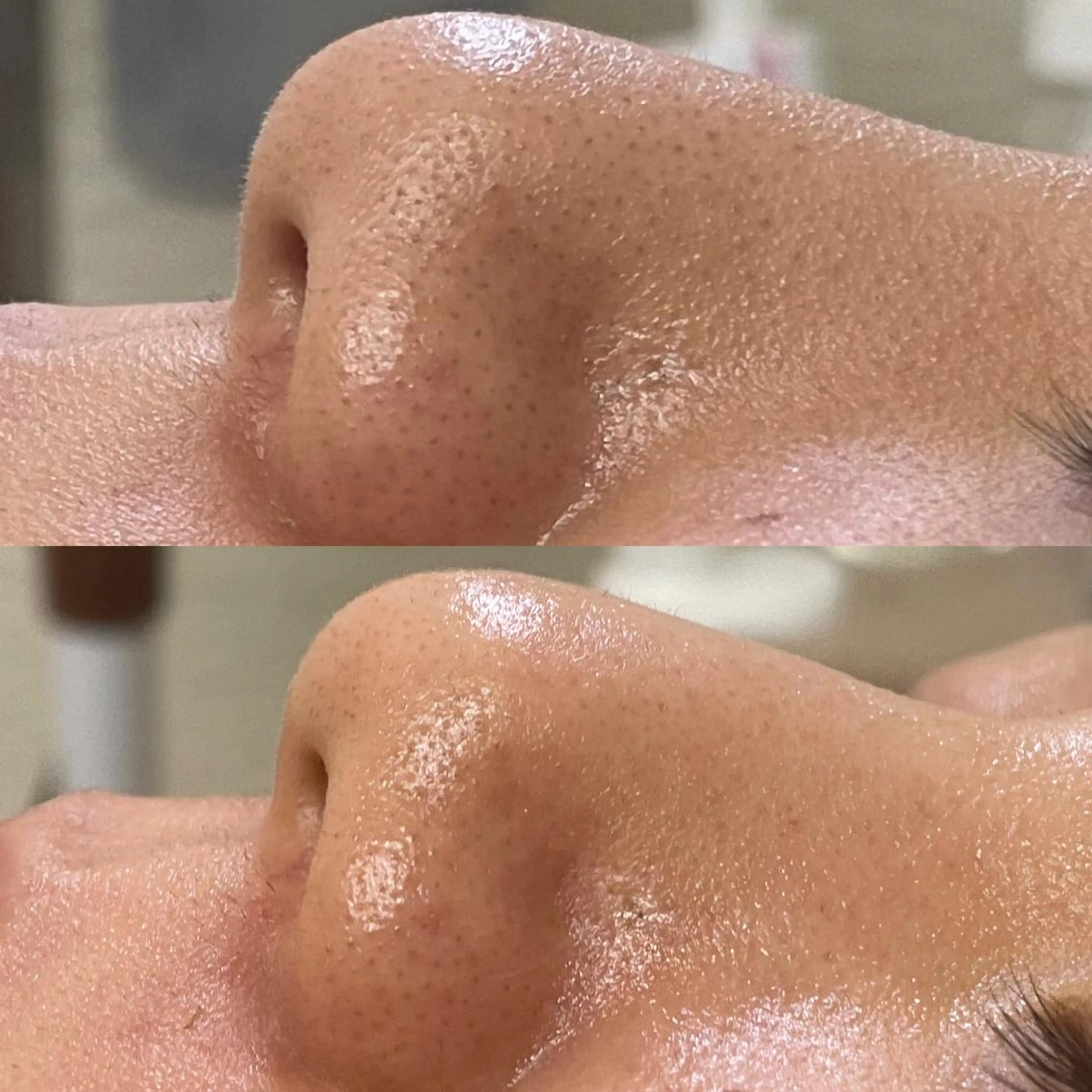 エステ 小野 優子の眉毛・アイブロウイメージ