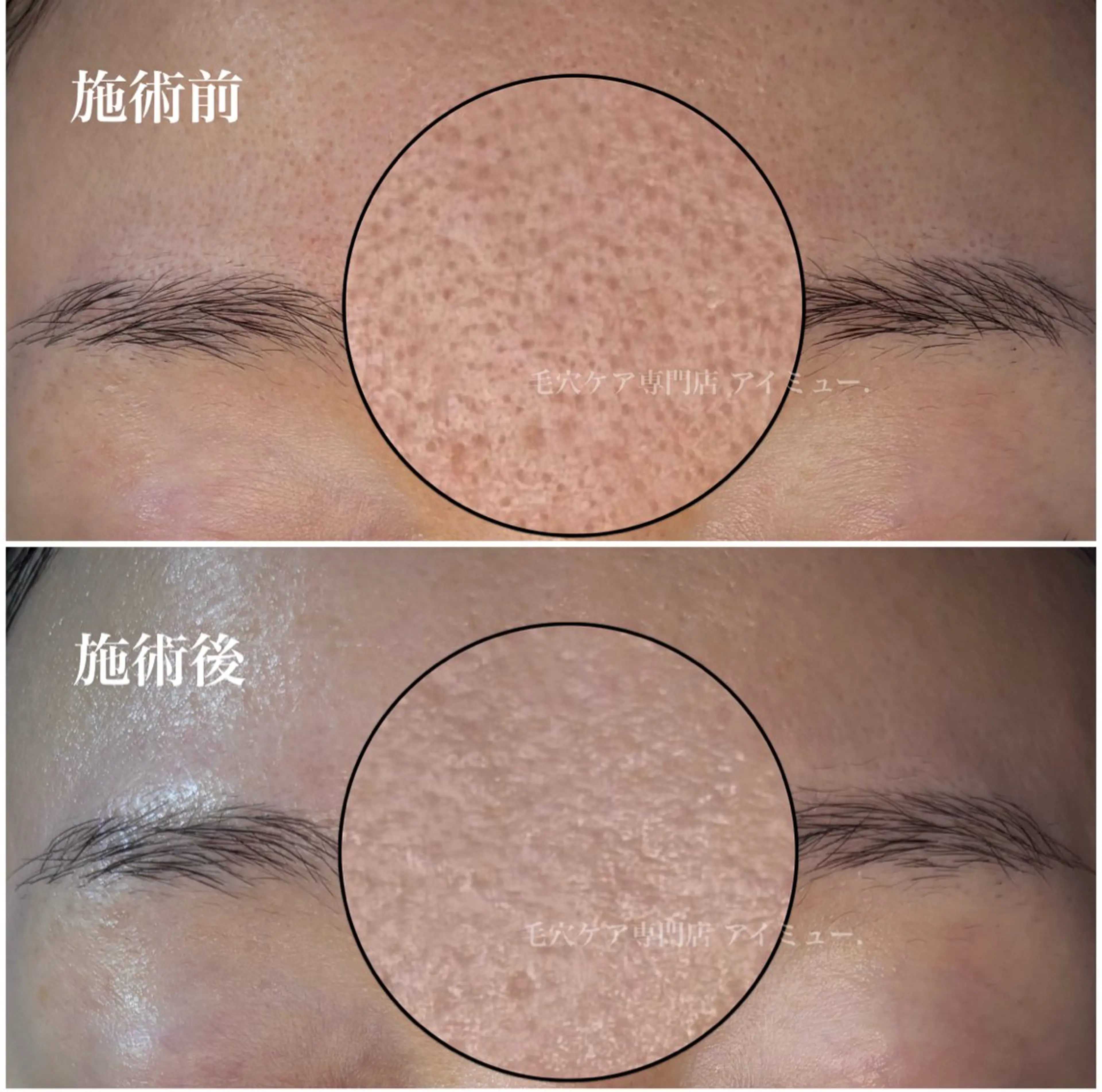 毛穴専門店アイミュー mamiのエステ・リラクイメージ