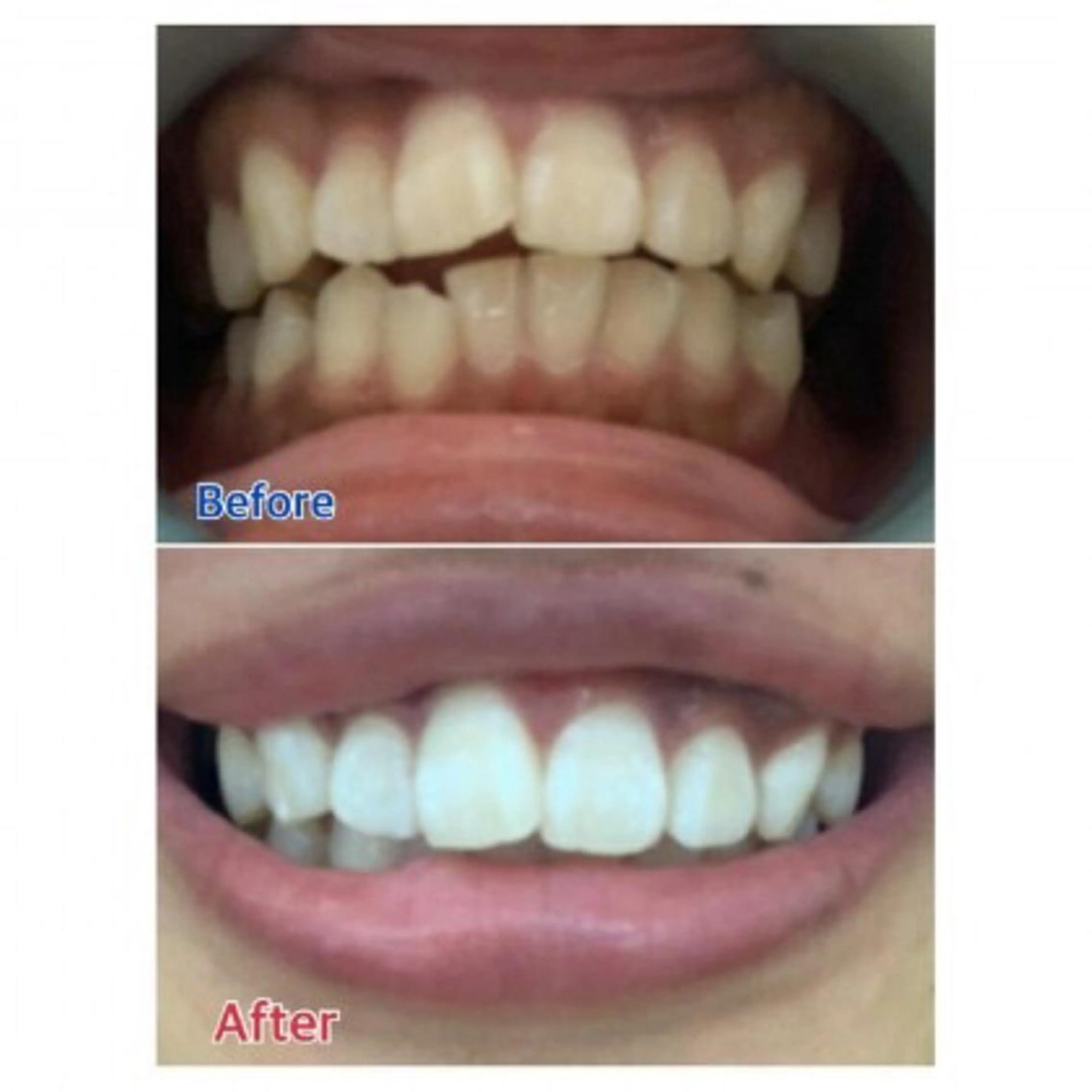 Ｍ渋谷 ホワイトニングのエステ・リラクイメージ