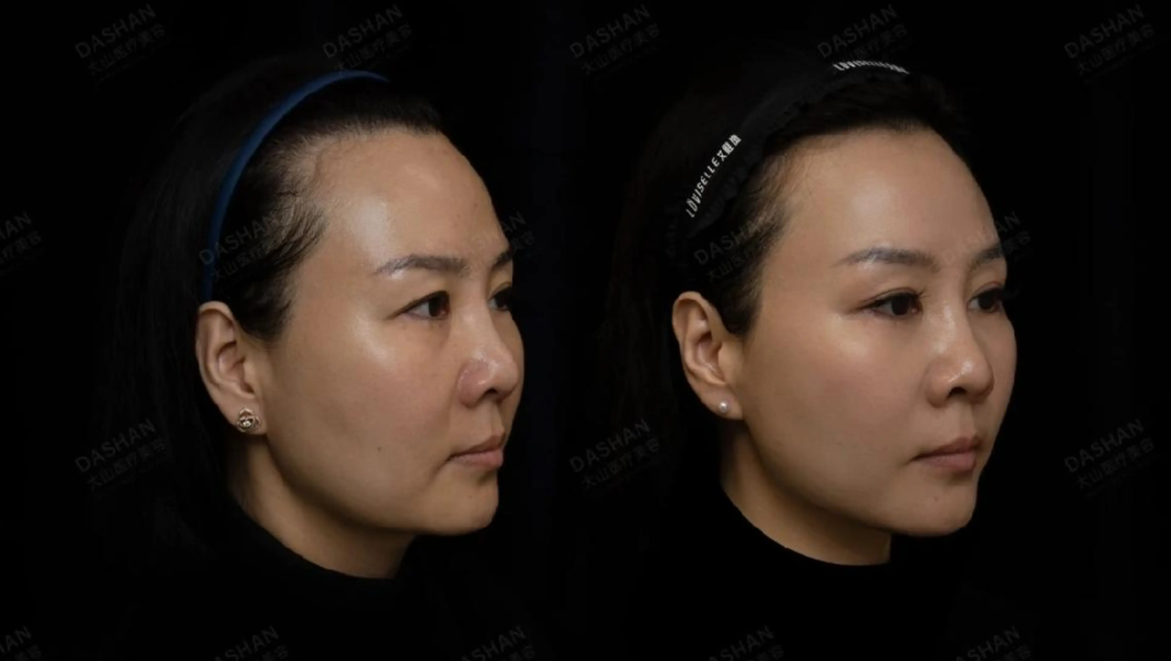 エステ aliaハーブ水光店 エステティシャン募集のエステ・リラクイメージ