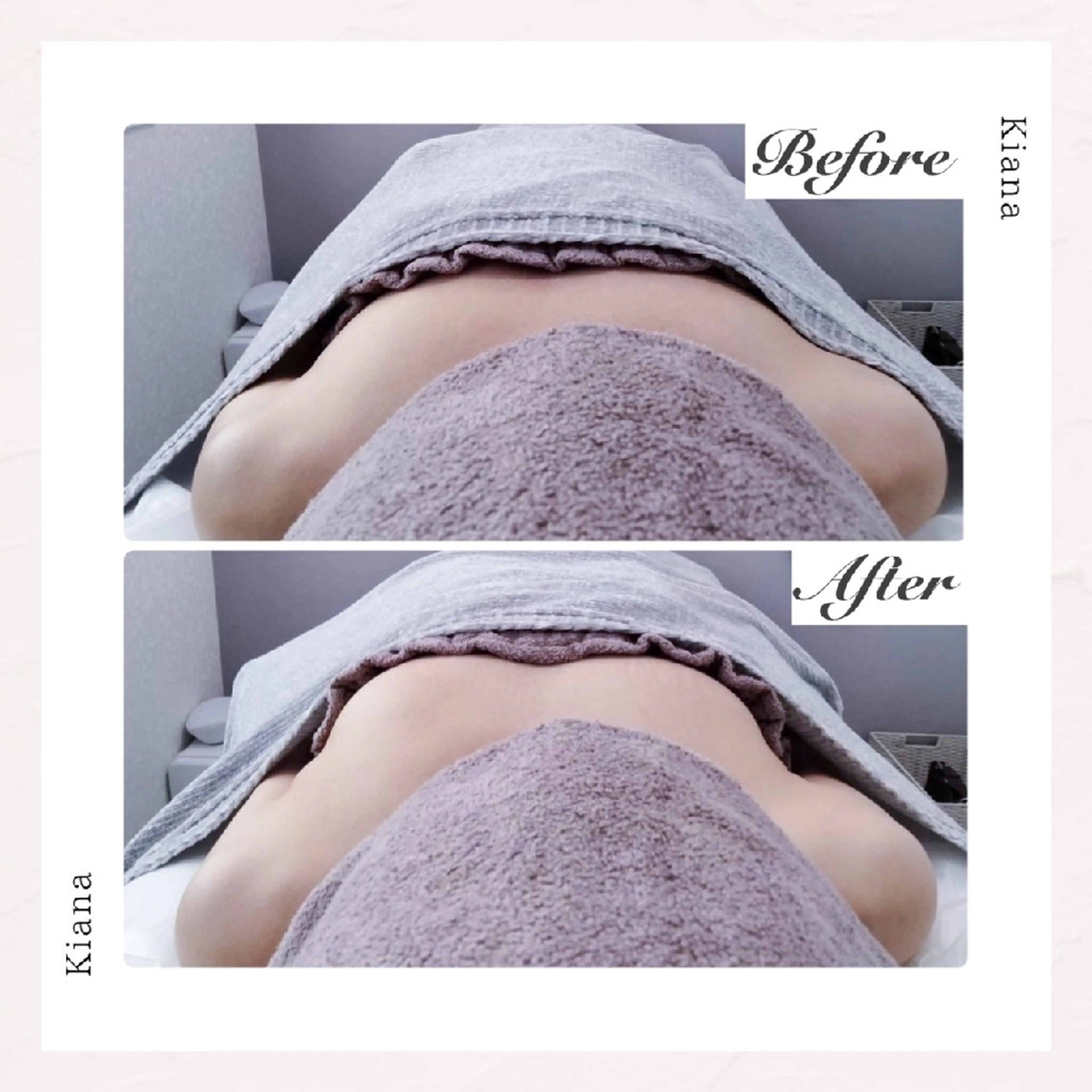 【バスト専門店 】 Kiana のエステ・リラクイメージ