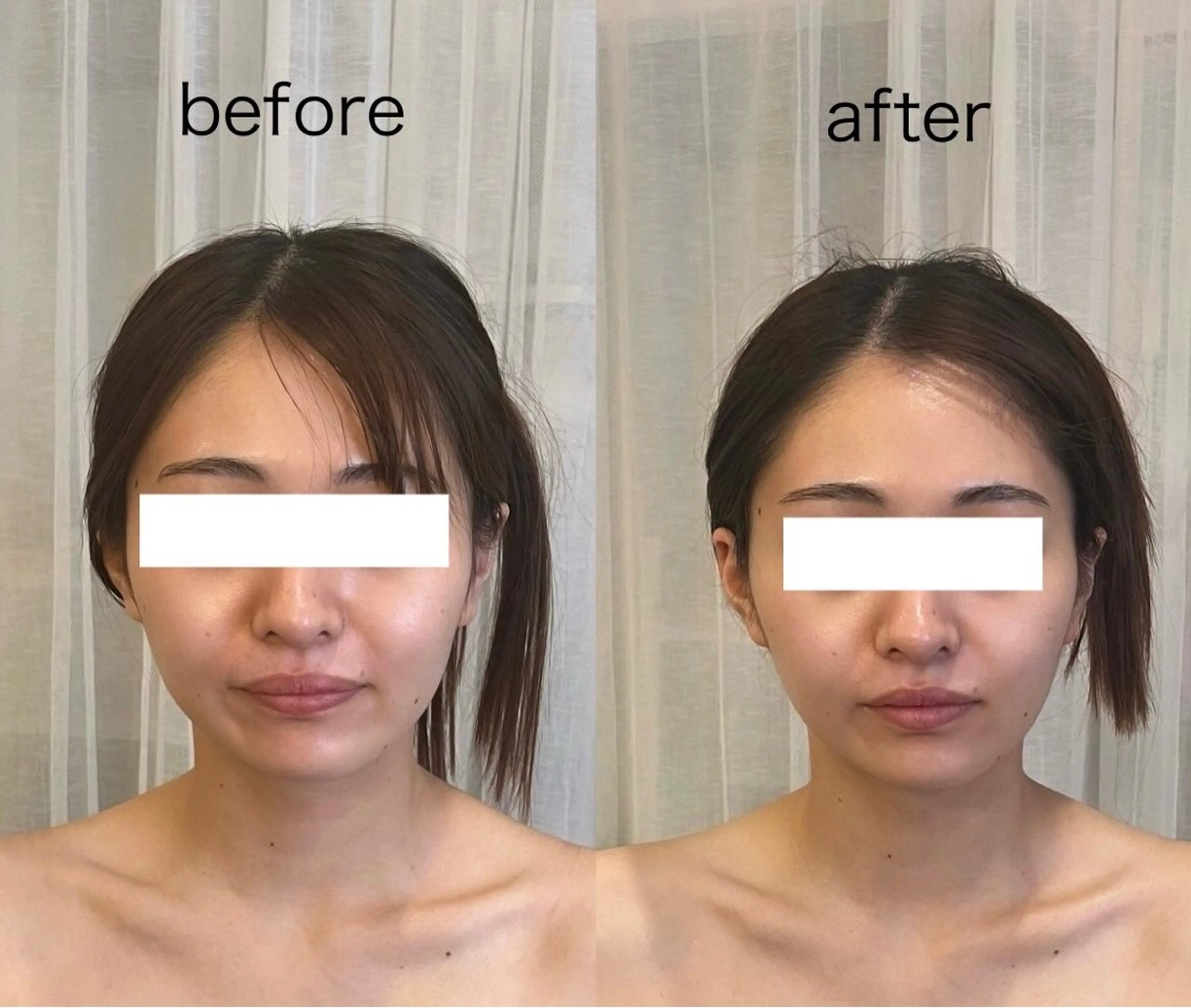 フェイシャル（スタンダード）の写真