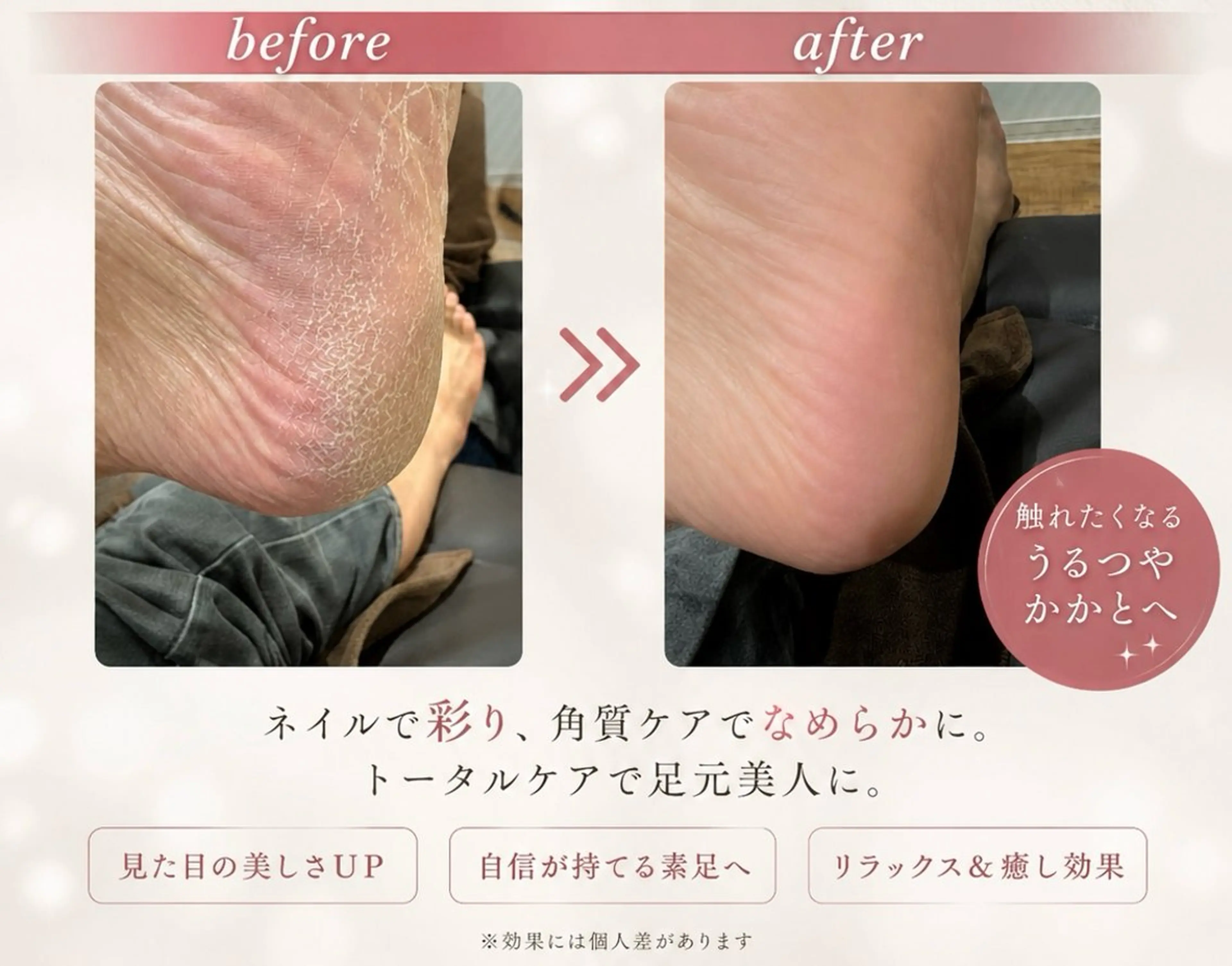 ネイル その他(ネイル) nailset/ asukaのネイルデザイン