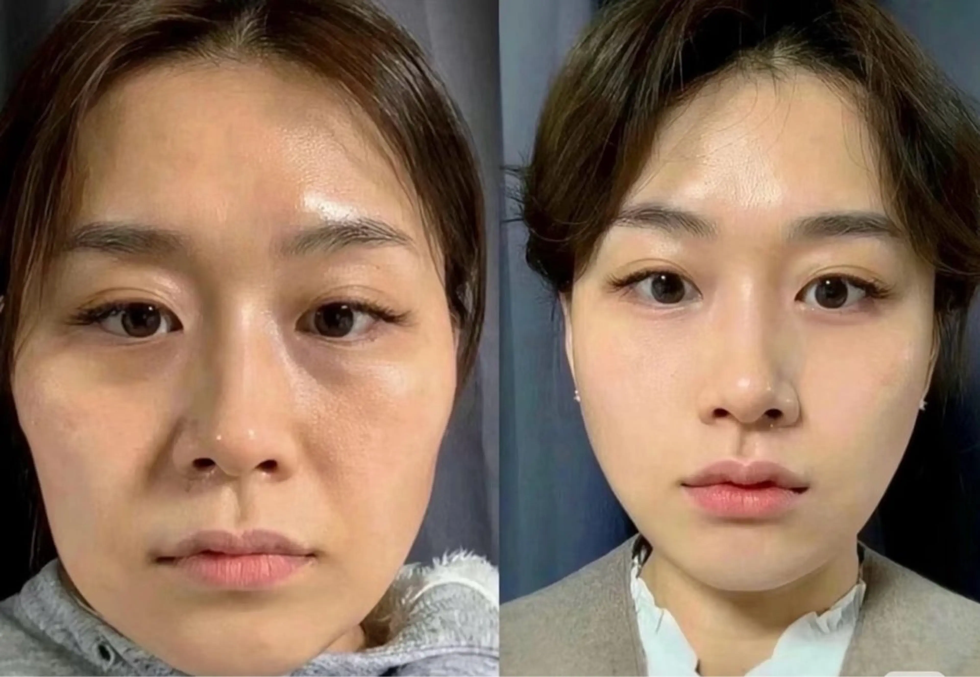 マツエク・マツパ エステ リラク 愛維美水光美肌専門店所属・愛維美水光美肌専門店 メンズレディースokのエステ・リラクイメージ