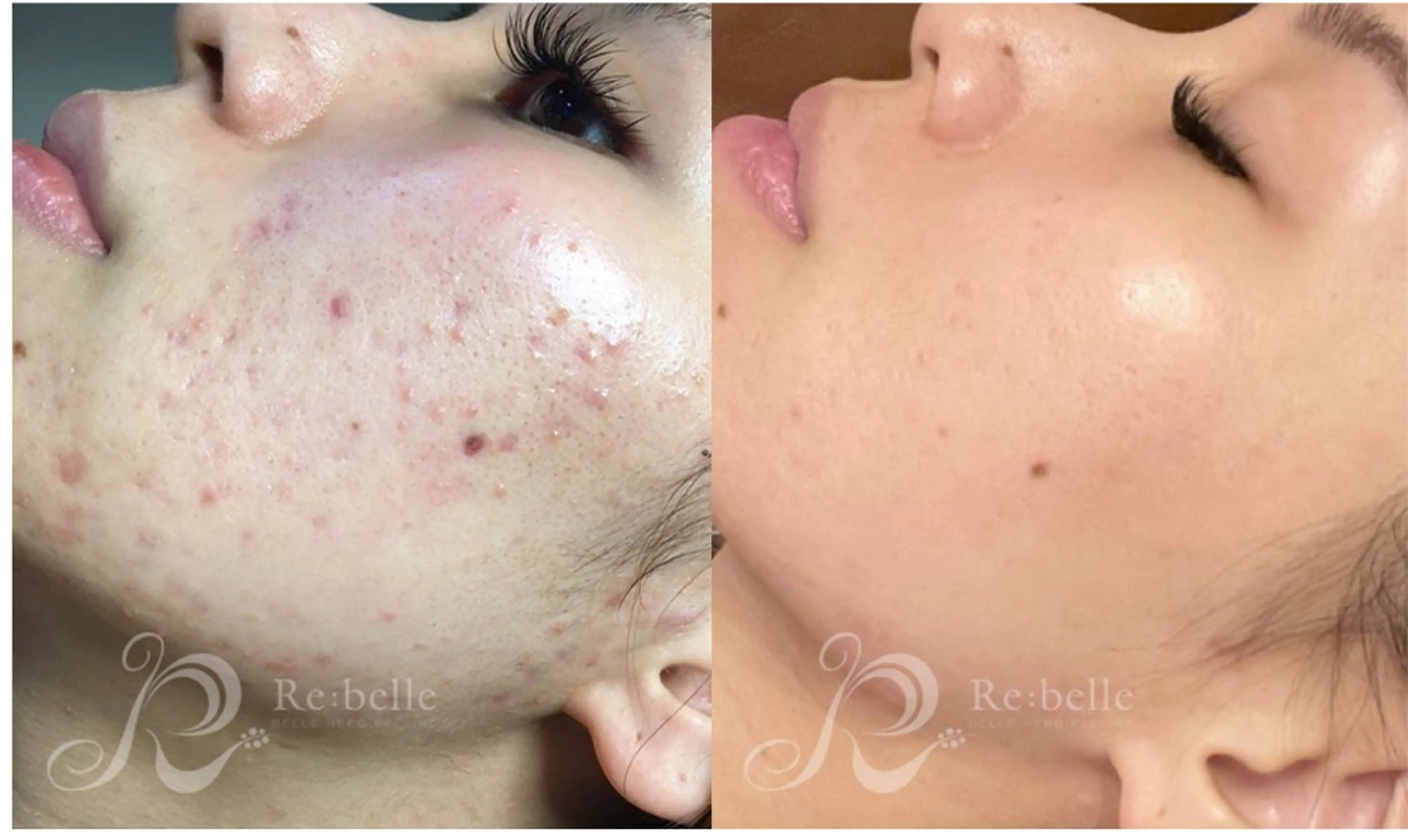 エステ Eyelash Salon MAVIE所属・Eyelash MAVIEのマツエク・マツパデザイン