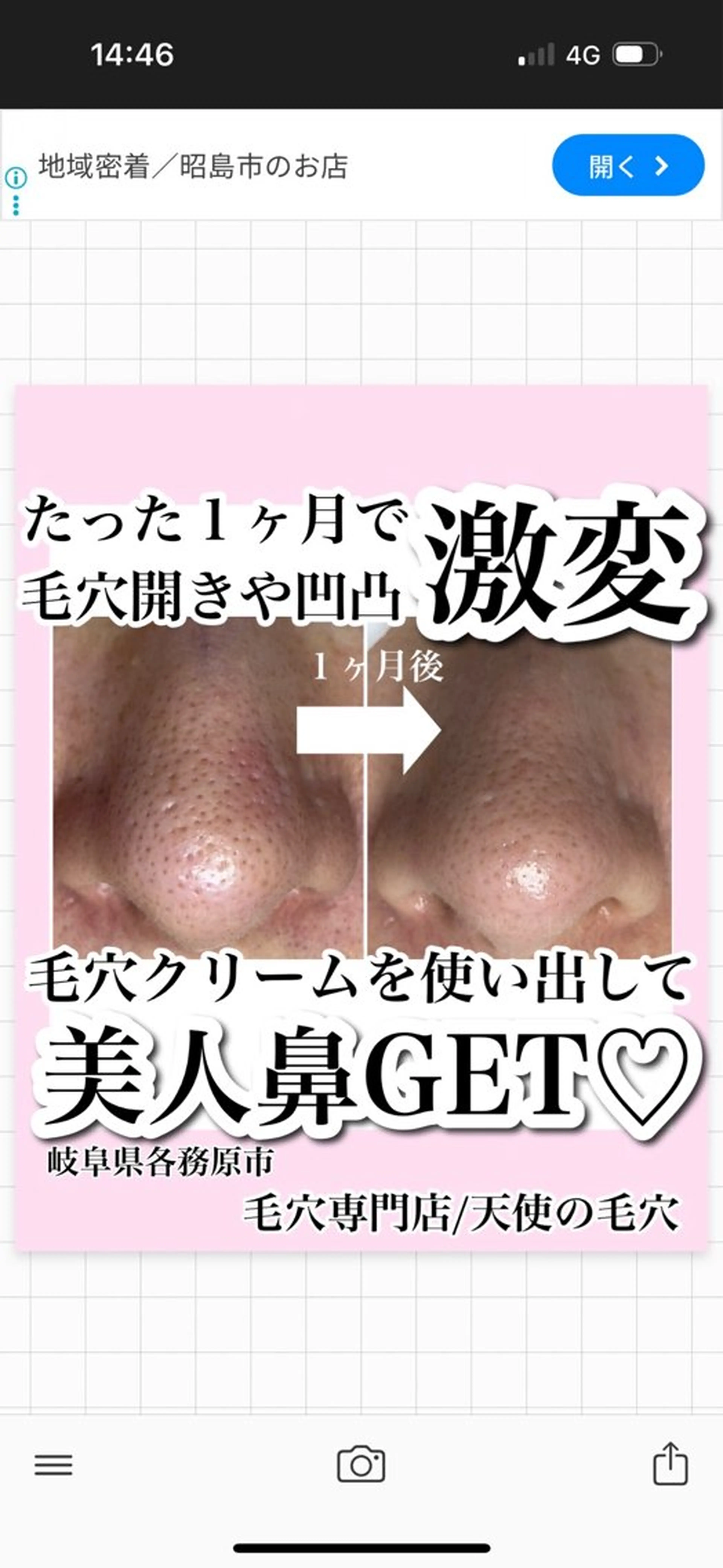 エステ 毛穴専門店【各務原】 天使の毛穴のエステ・リラクイメージ