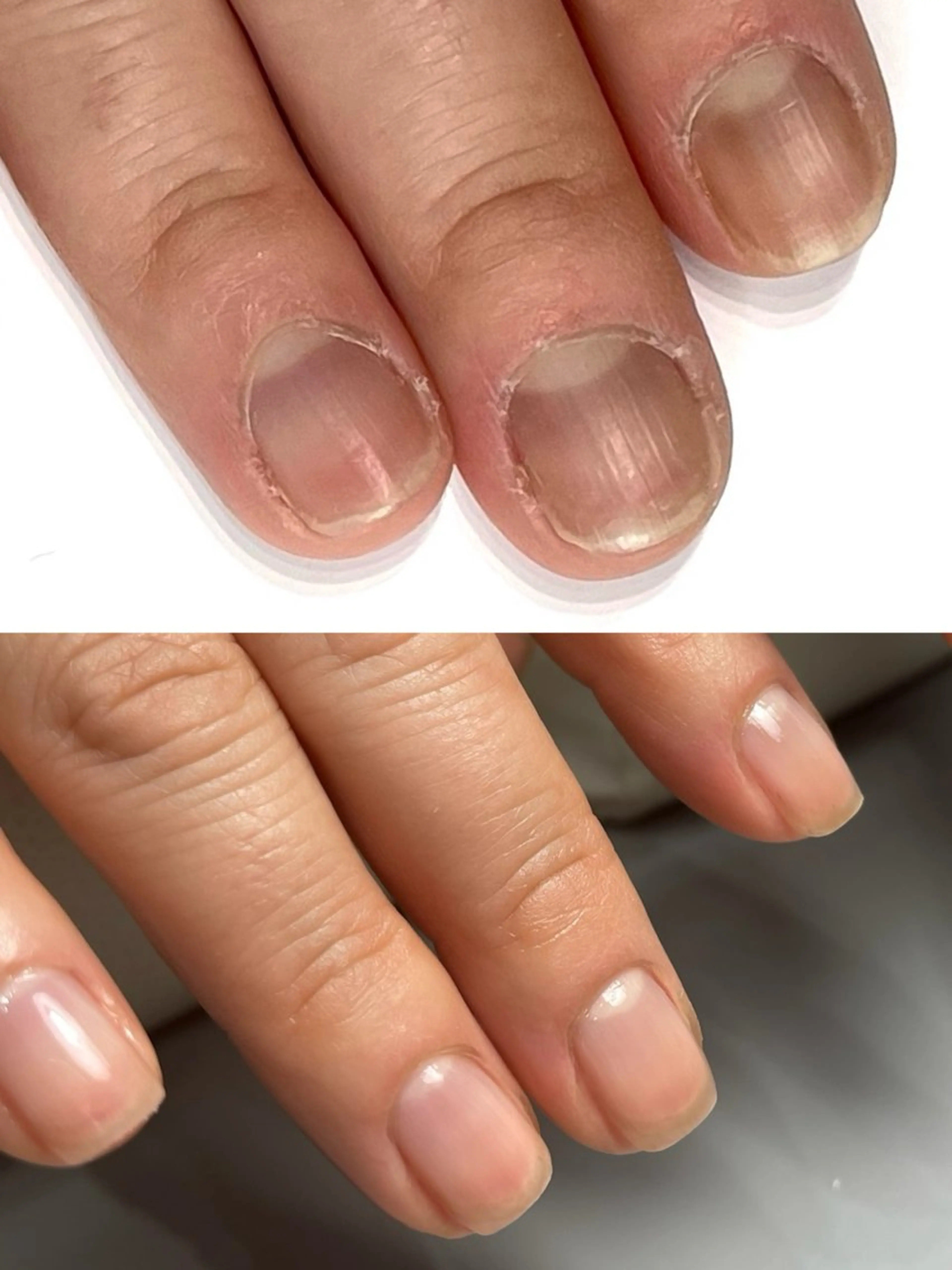 ネイル Aim* 深爪・自爪育成専門店のネイルデザイン