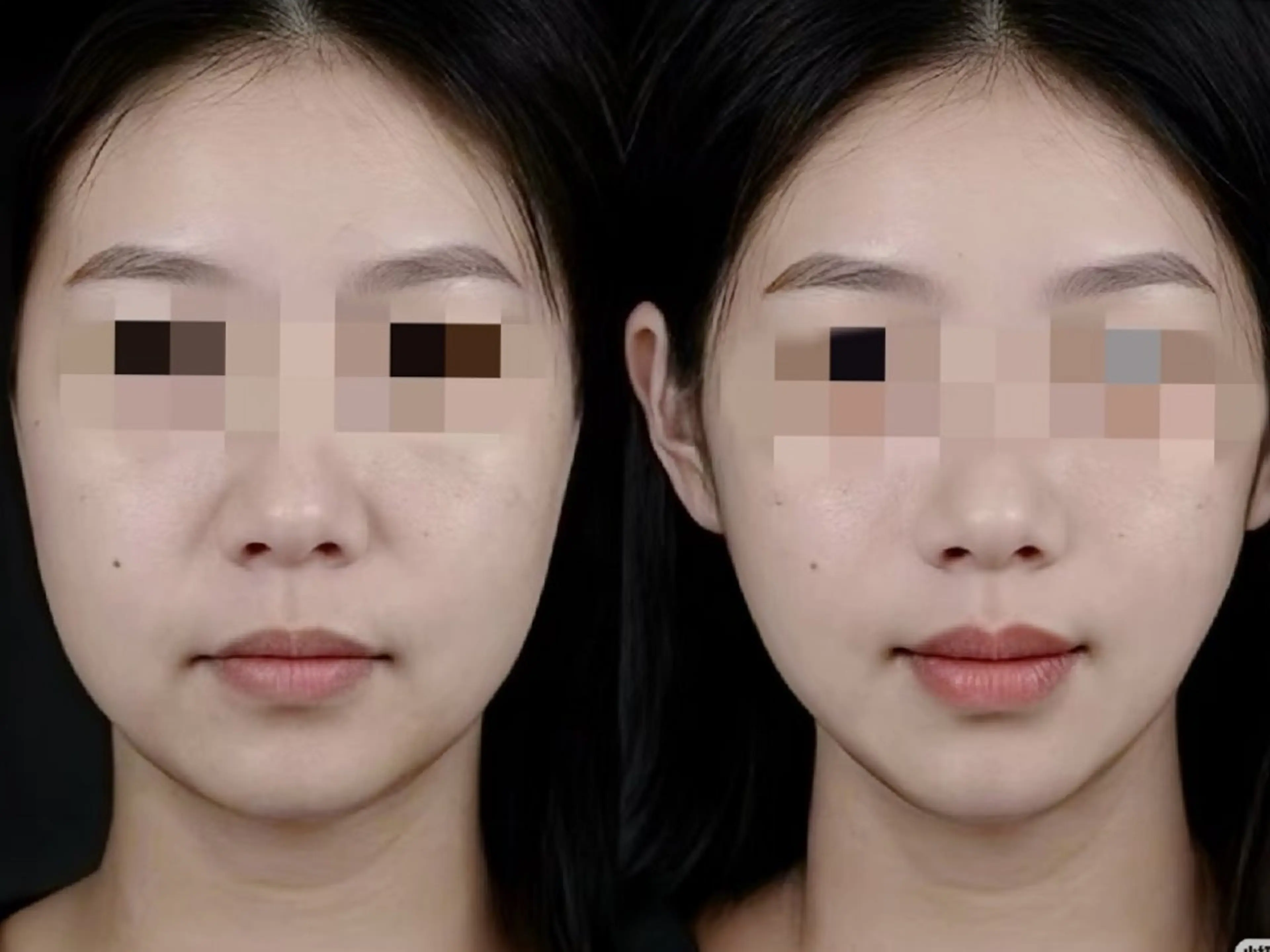 エステ aliaハーブ水光店 エステティシャン募集のエステ・リラクイメージ