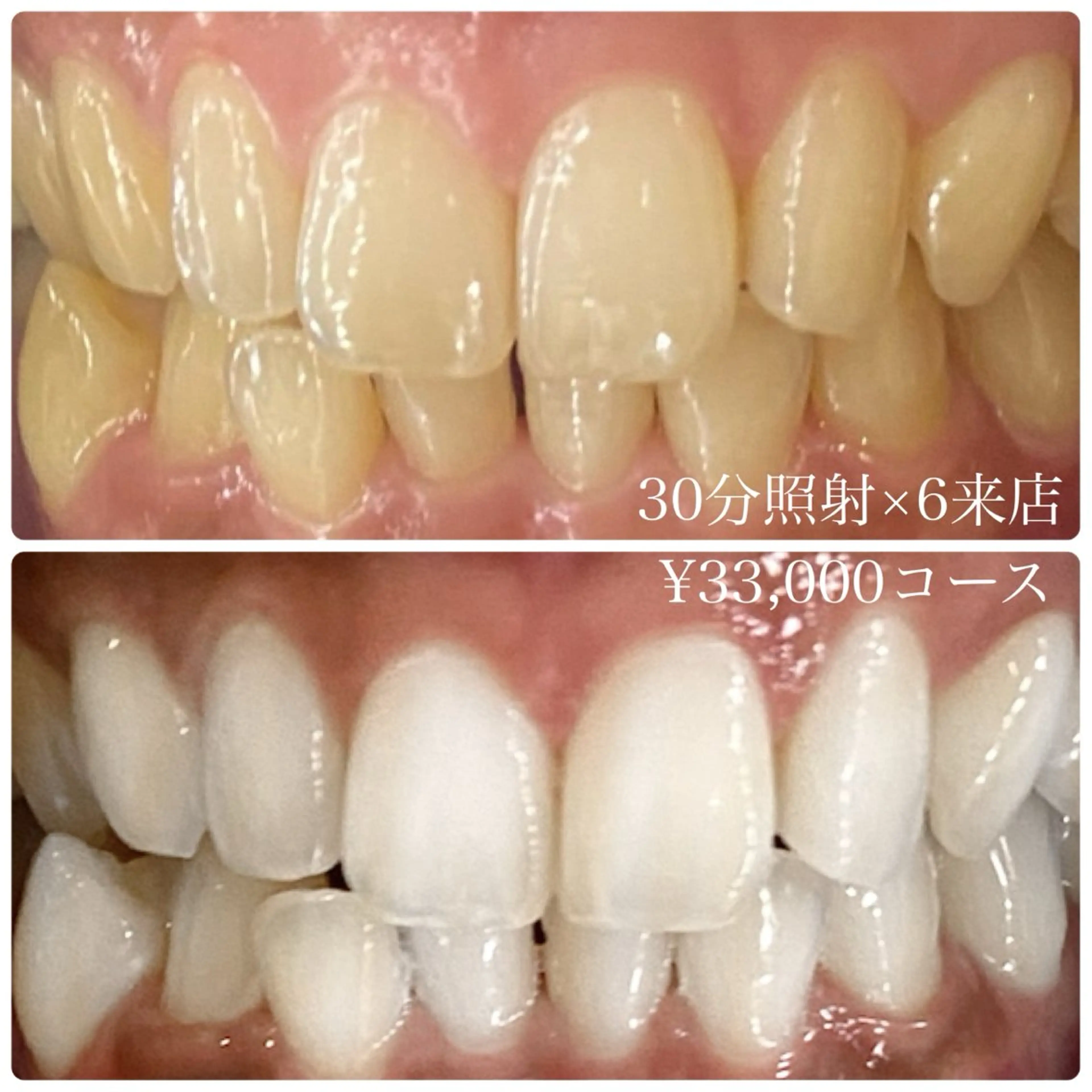 メンズ ホワイトニングルーム 川崎店所属・ホワイトニング ルーム 川崎店のその他イメージ