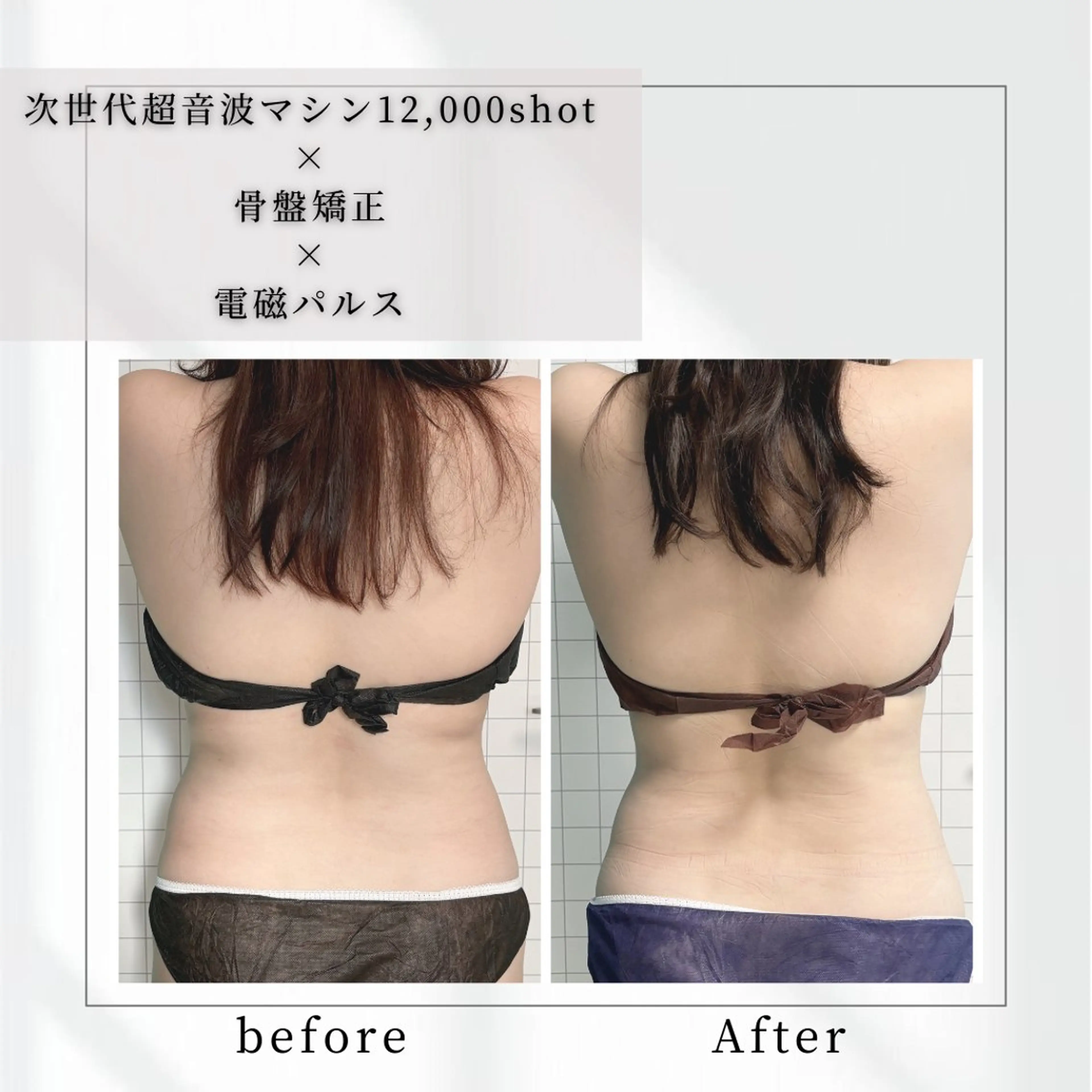 小顔矯正専門店 【RED】池田のエステ・リラクイメージ