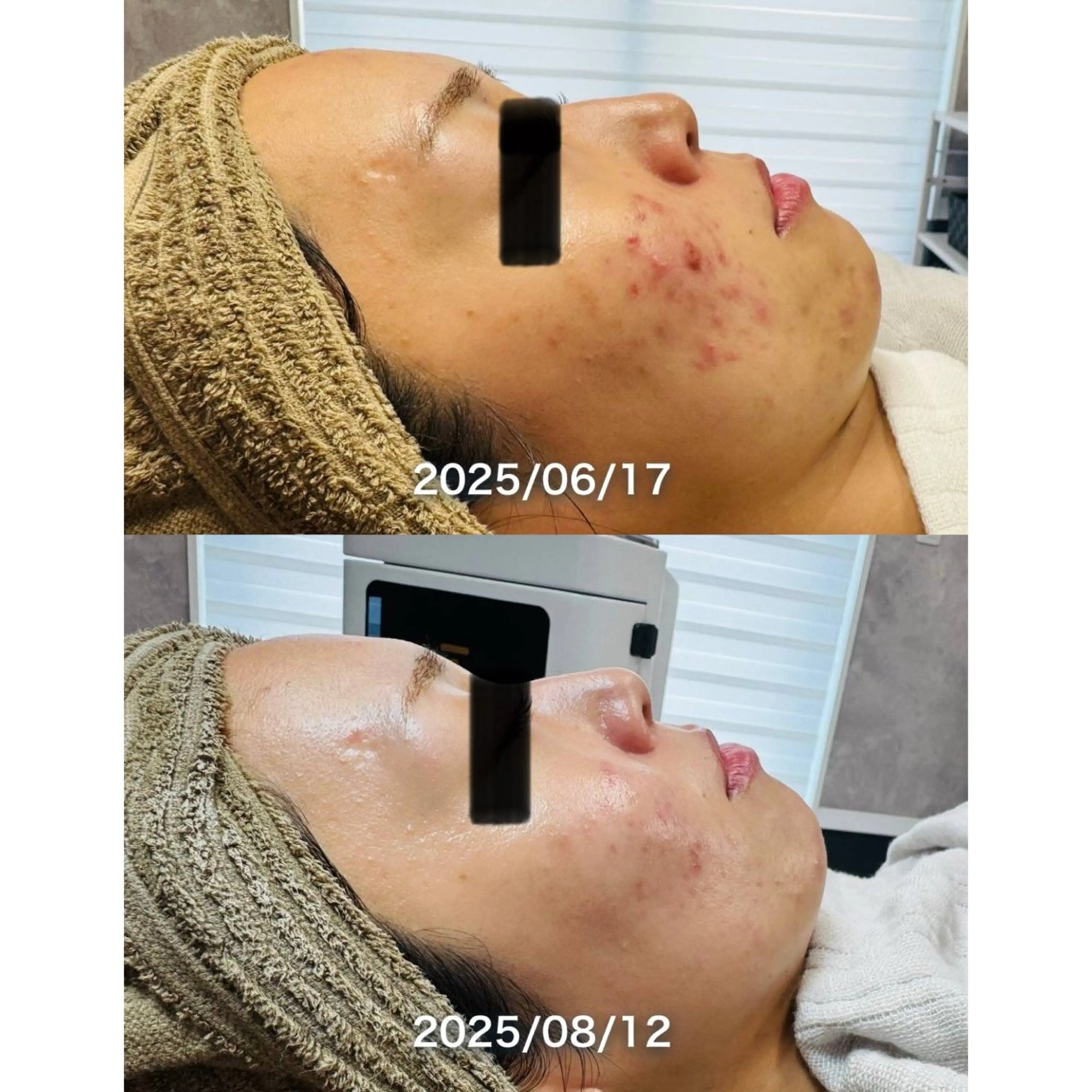 LukeBeauty salonのエステ・リラクイメージ