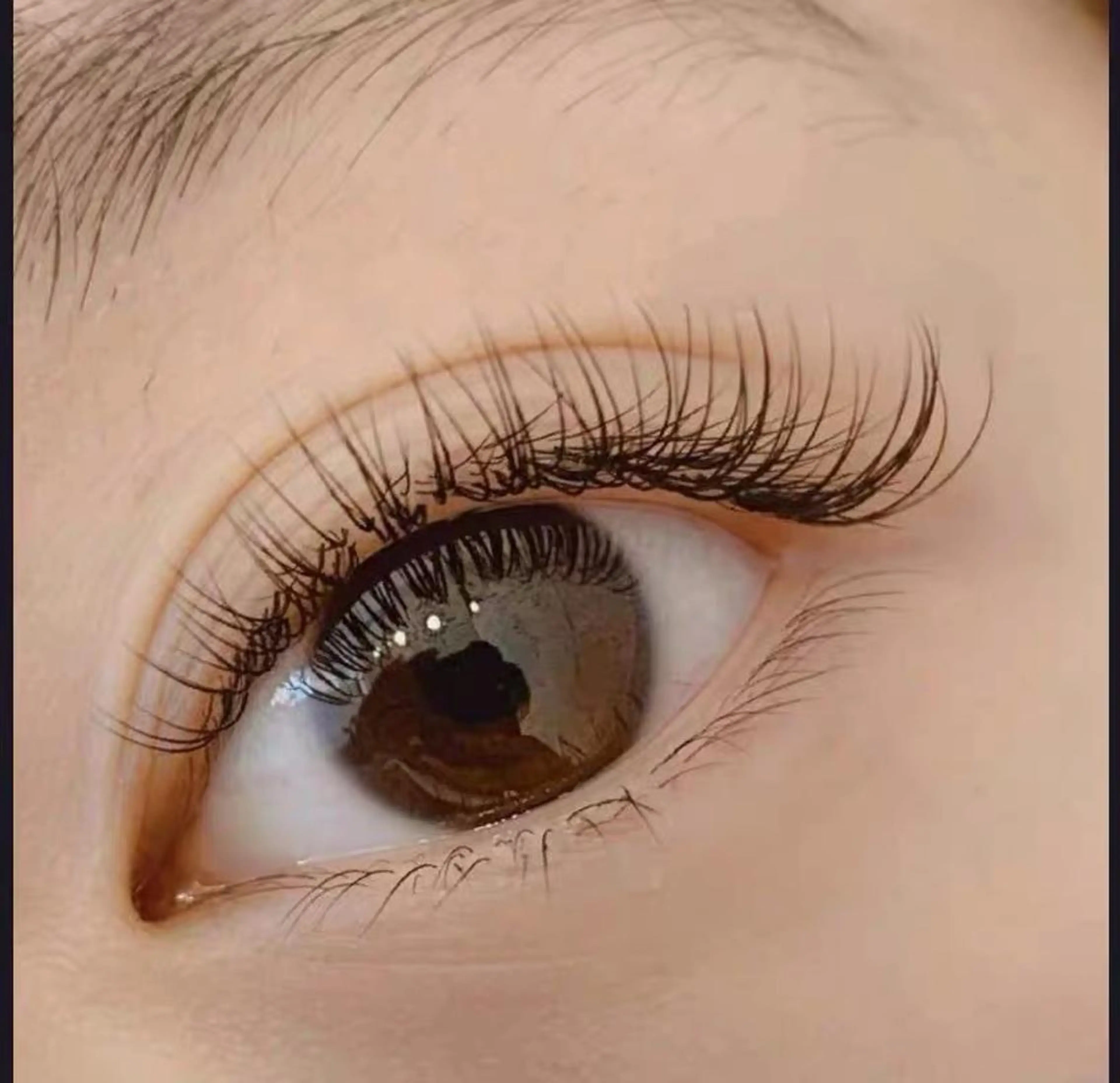 フラットラァシュ140本の写真