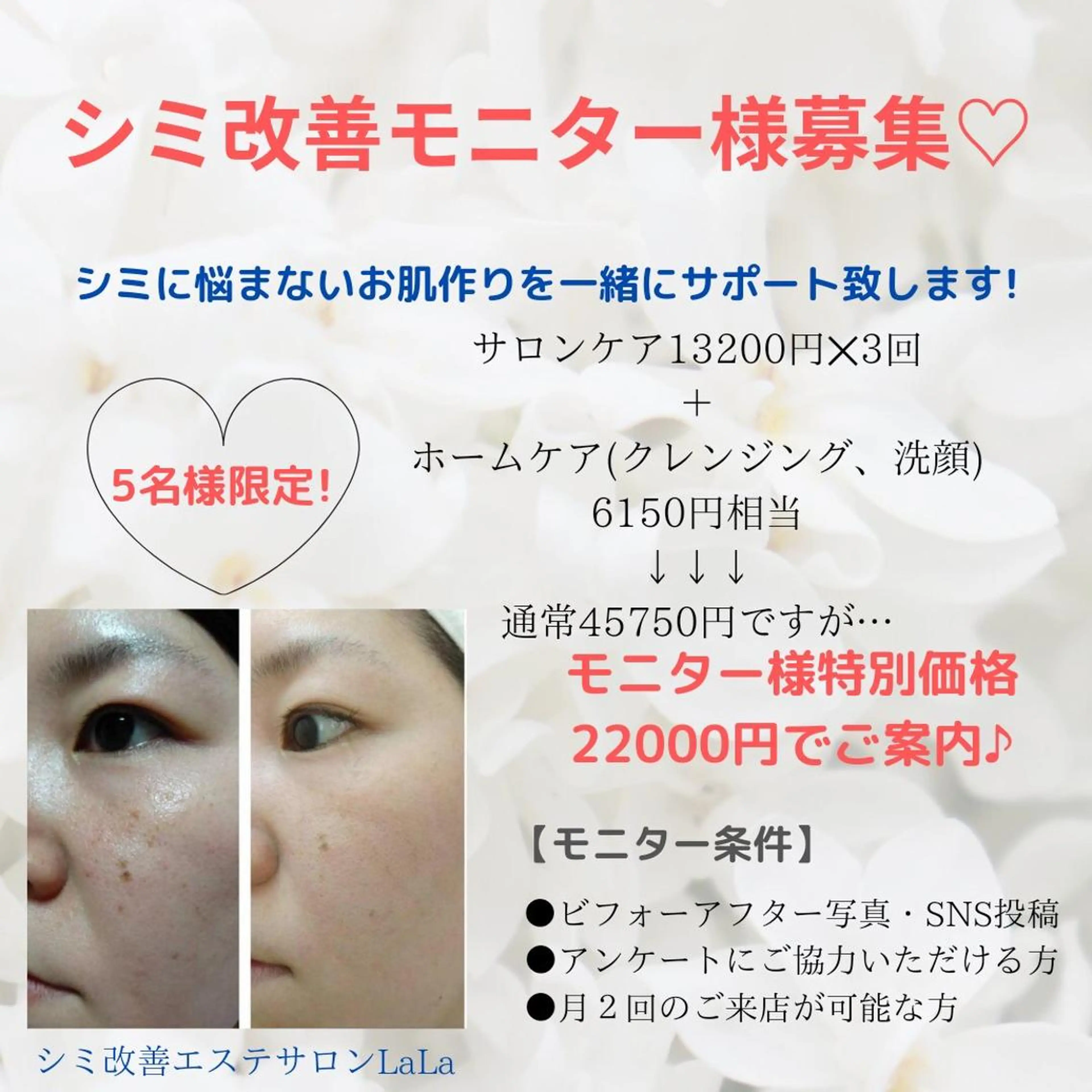 プライベートサロン LaLa 北山まいこのエステ・リラクイメージ