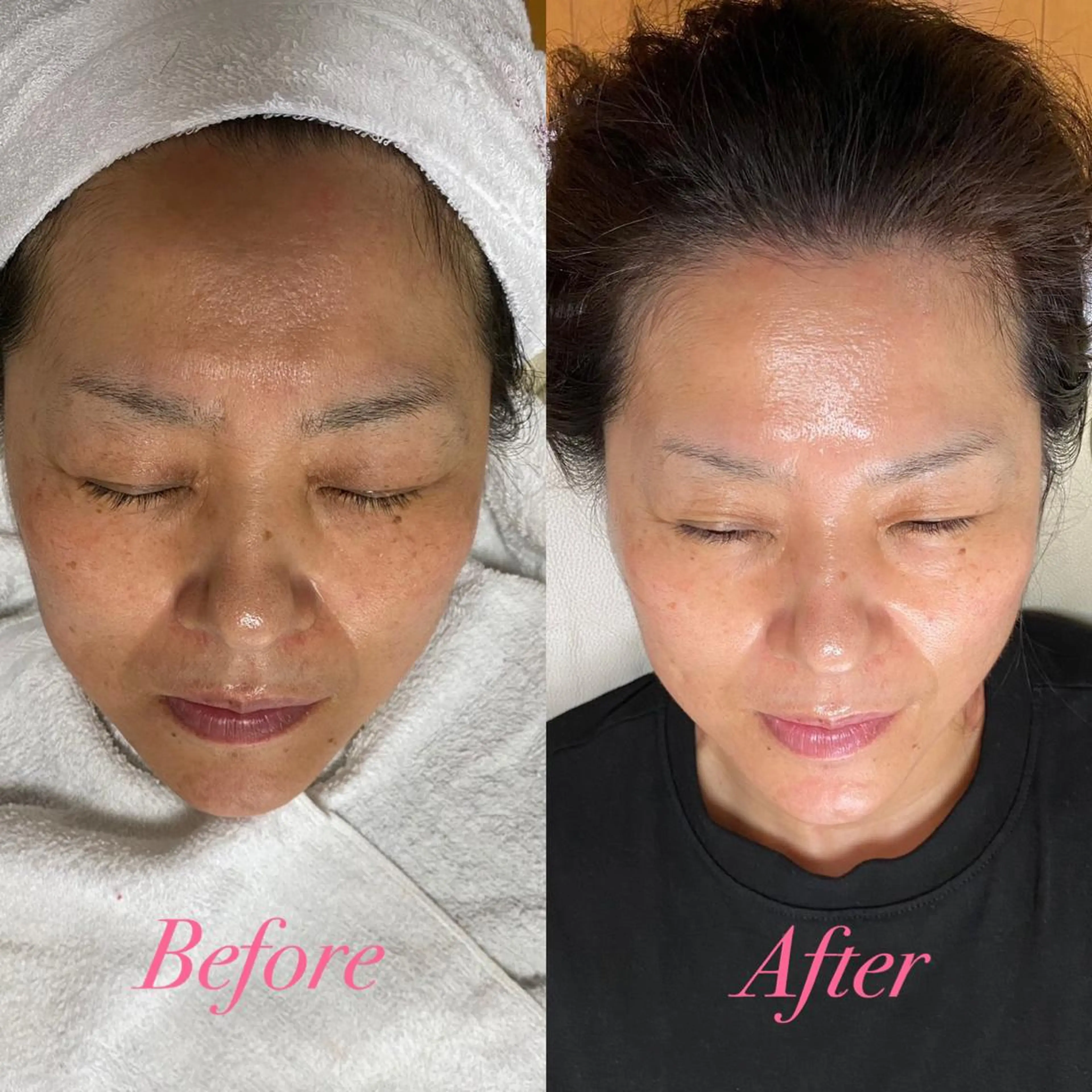 💗[全員]お悩み別フェイシャル💗の写真