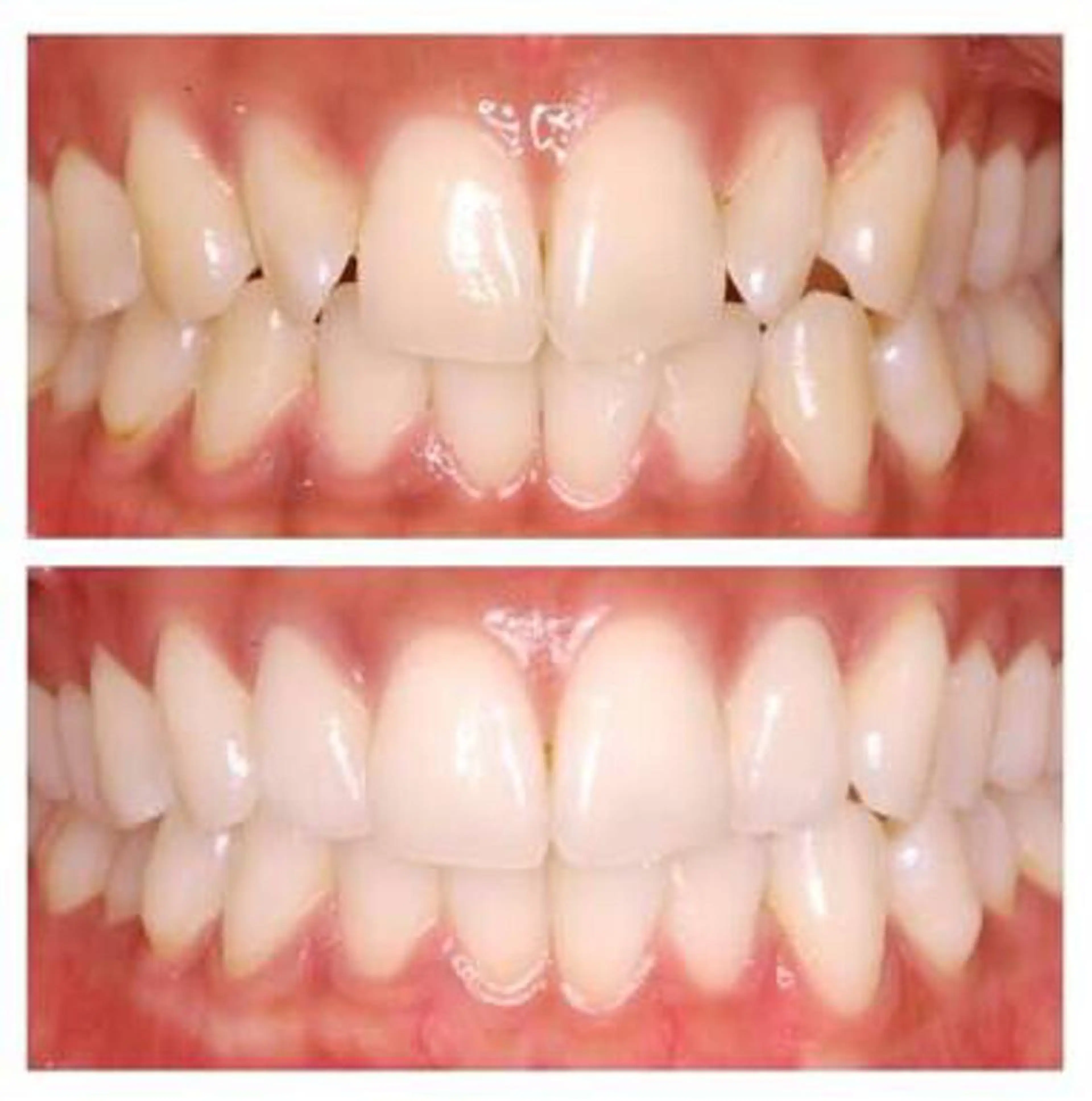 セルフホワイトニング 松原のエステ・リラクイメージ