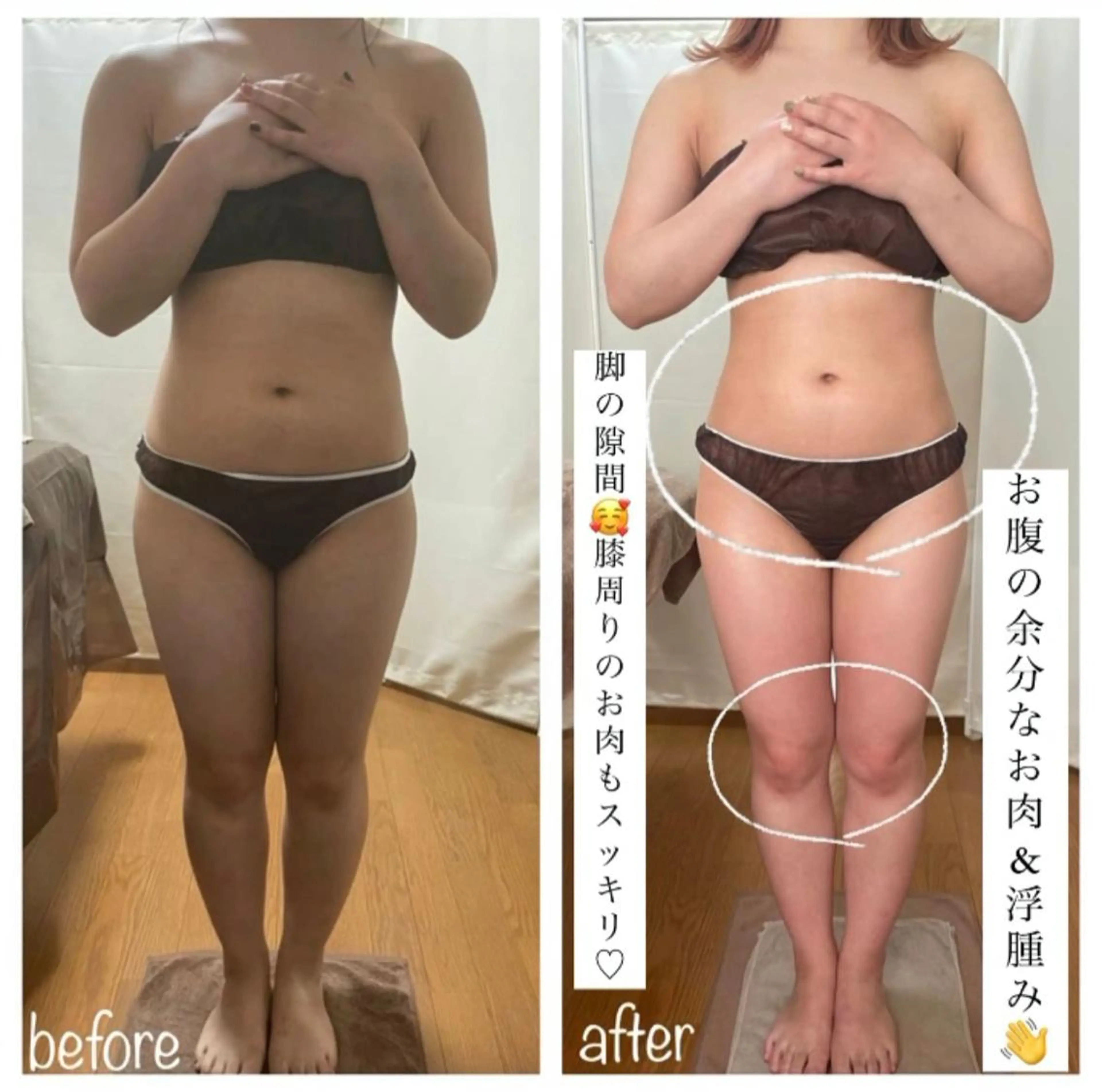 biloop所属・《本気痩せ×疲労改善 》  BILOOPのエステ・リラクイメージ