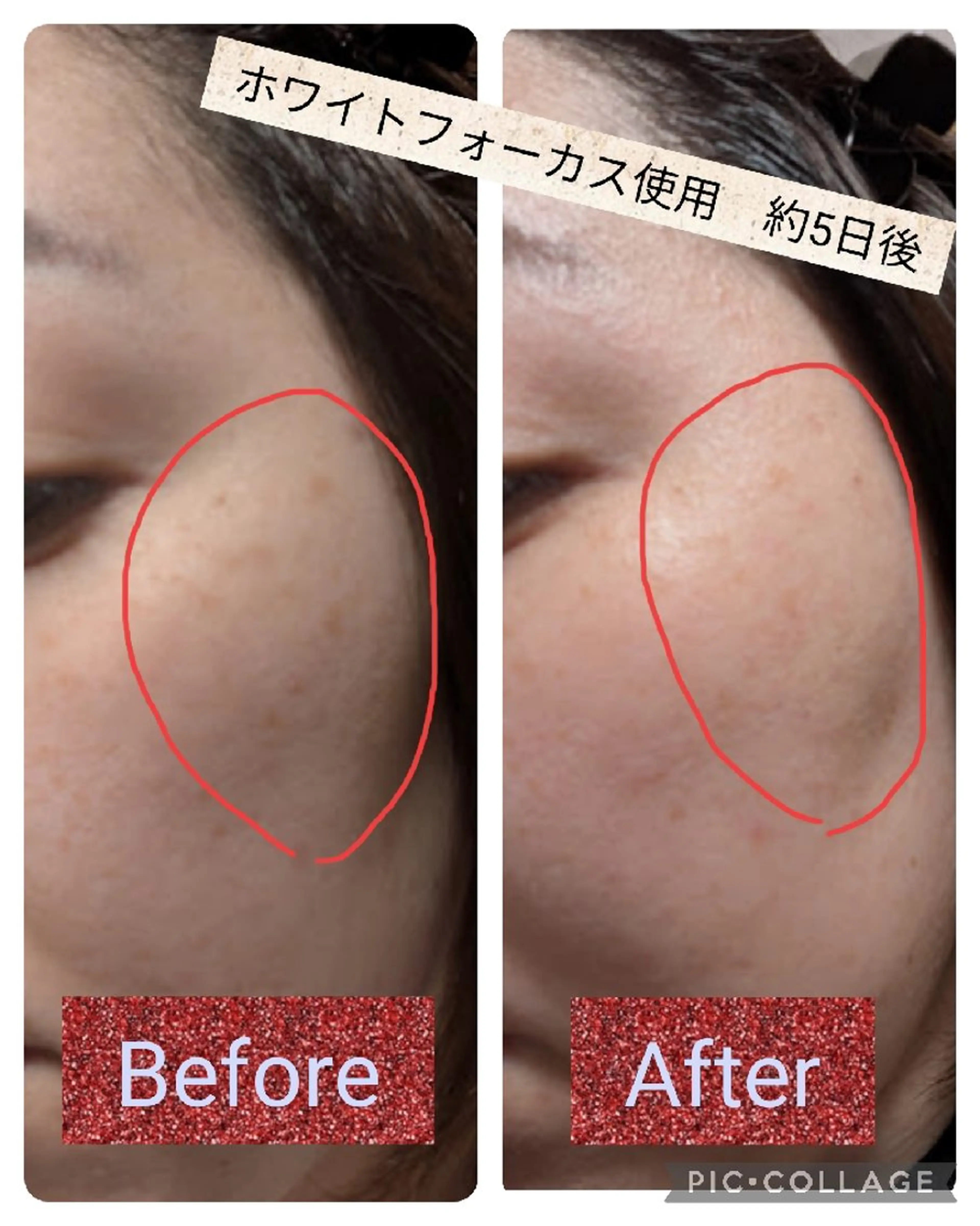 iVan❤️ shioriのエステ・リラクイメージ