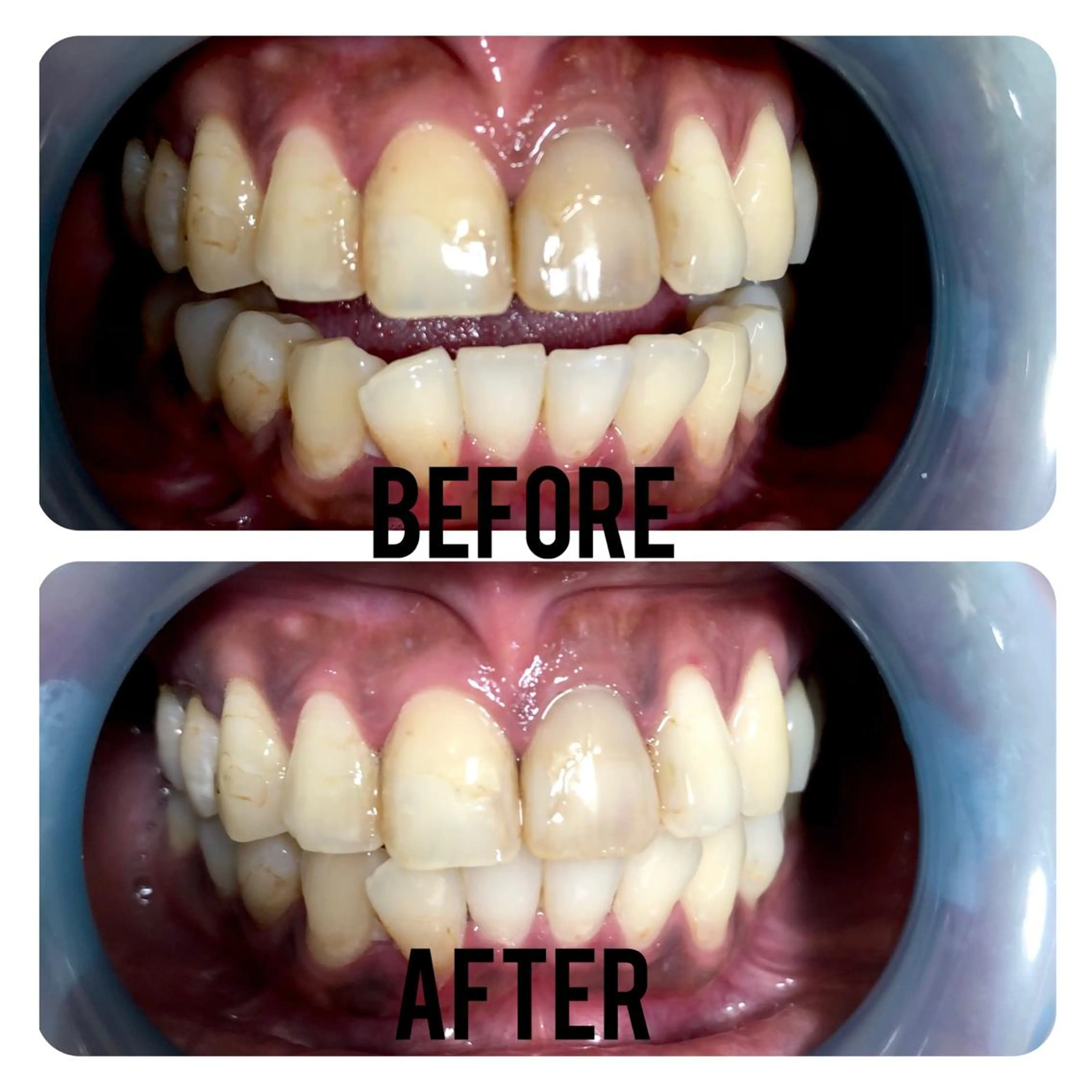 その他 two nailのネイルデザイン