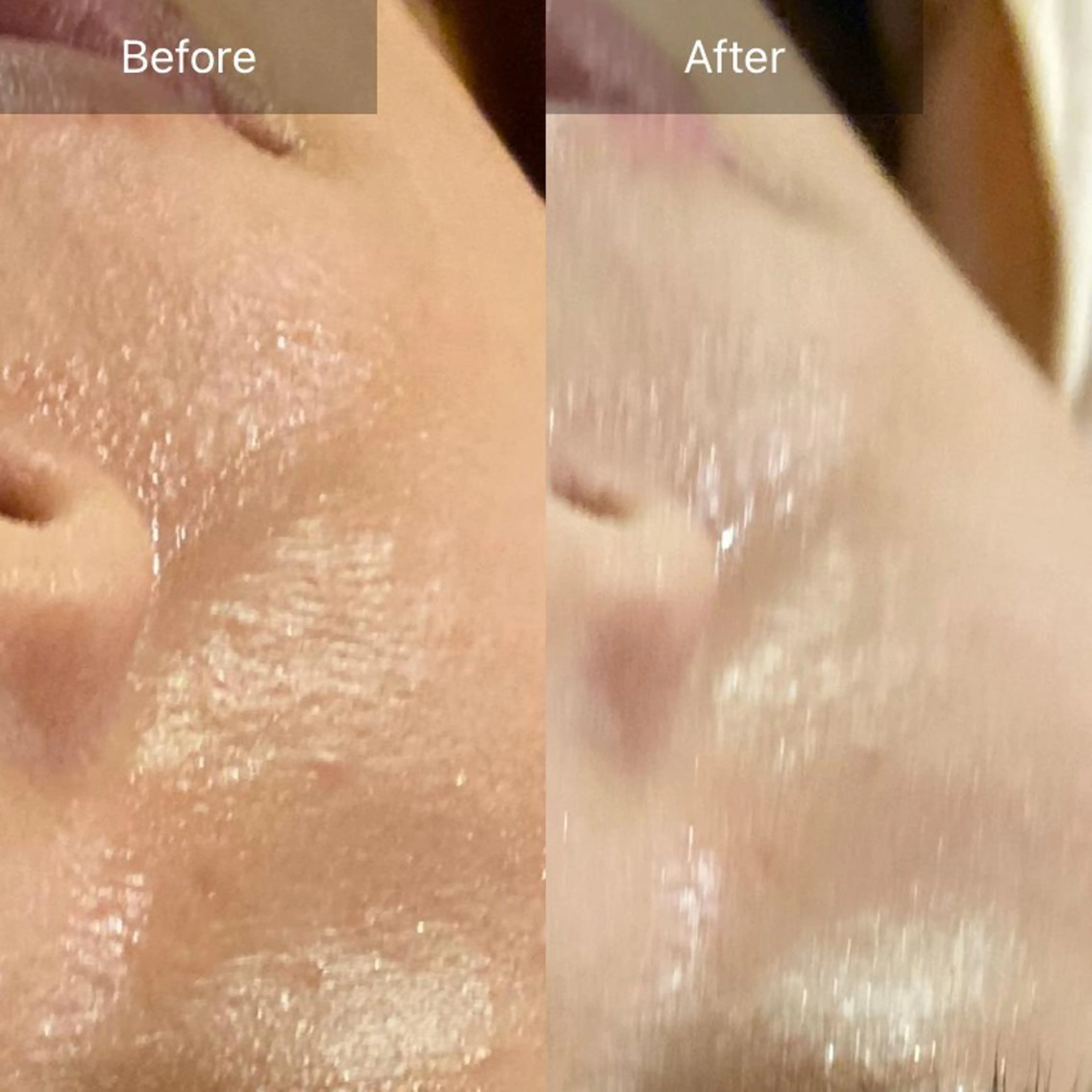 毛穴から始める肌メン テマンダリンオレンジのエステ・リラクイメージ