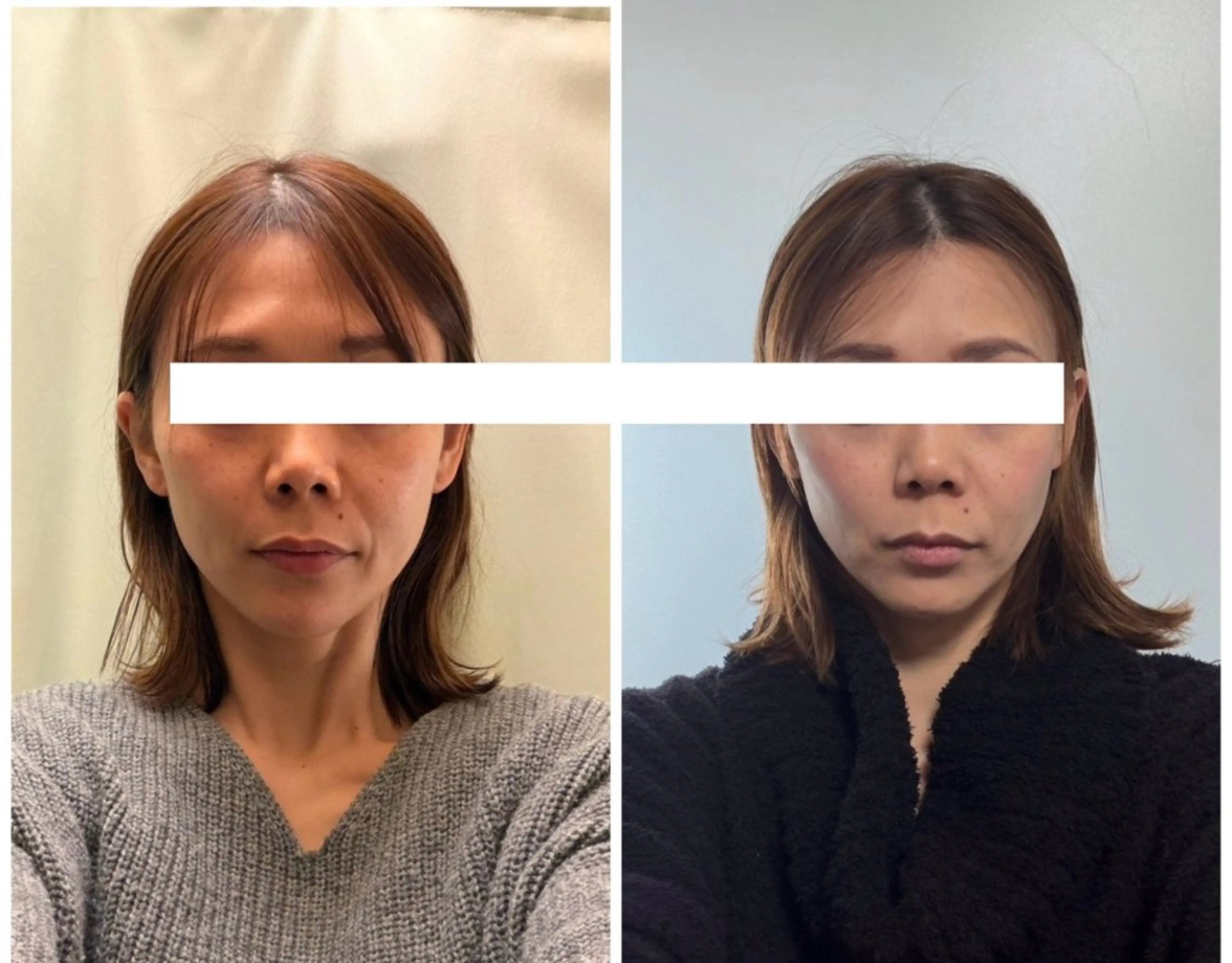 丸顔さんの救世主 高田 くみのエステ・リラクイメージ