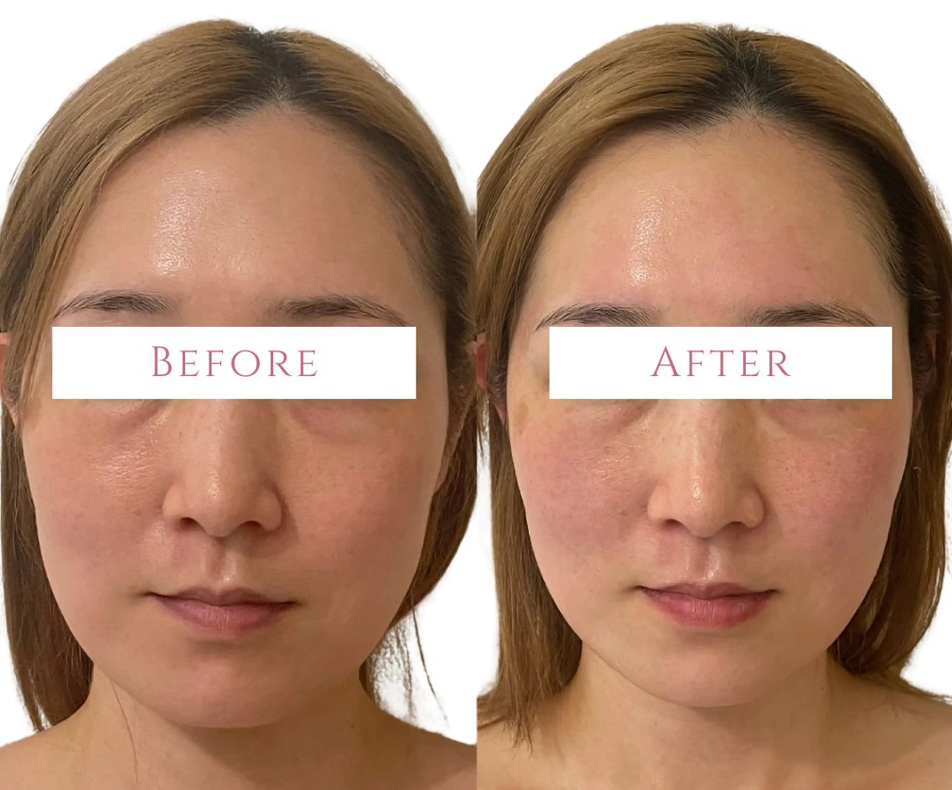 エステ 【小顔痩身専門看護師 サロンSONA】のエステ・リラクイメージ