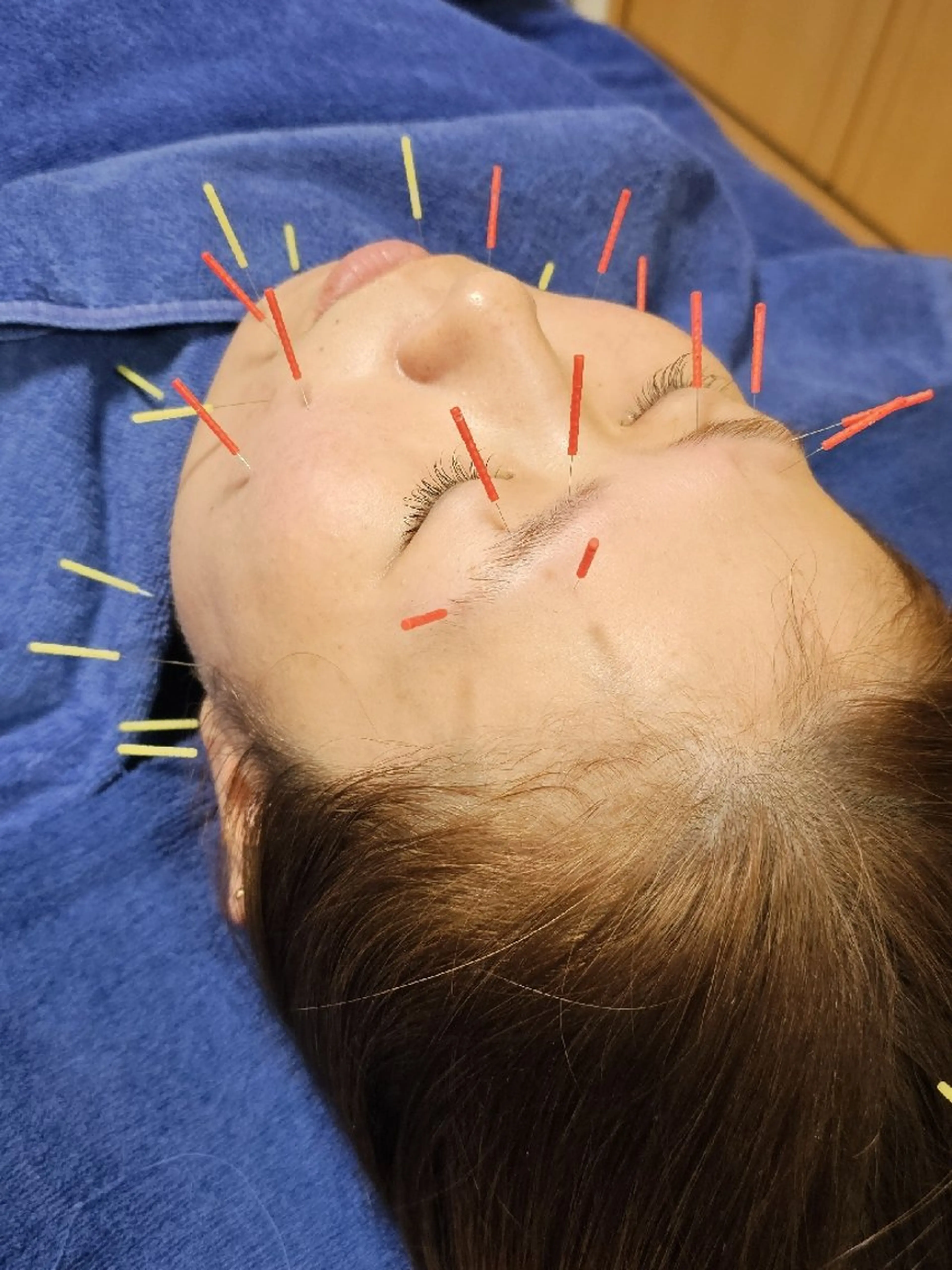 その他 鍼灸整体院 アレンジのその他イメージ