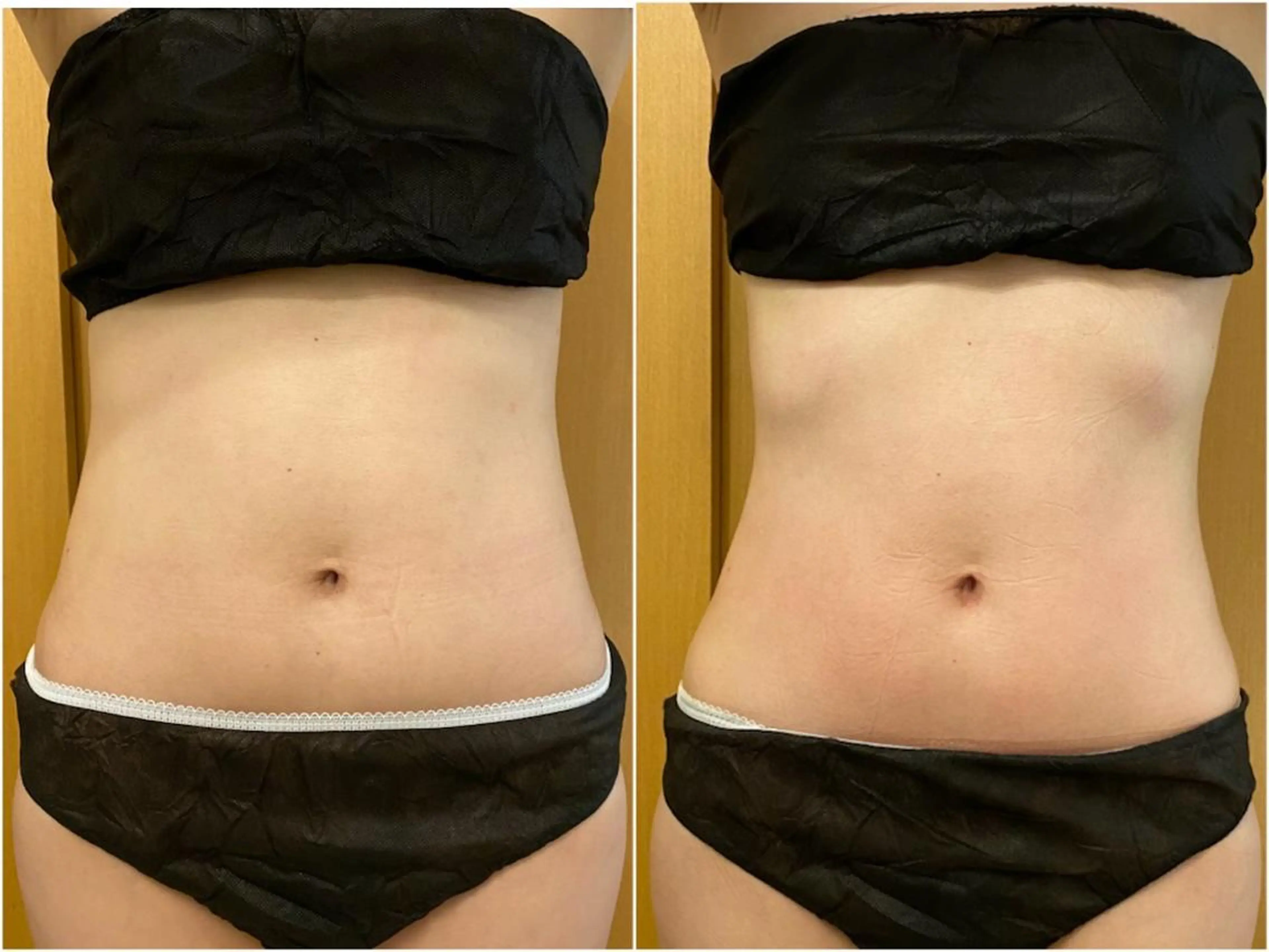 ララ/ハーブ メゾンリュバンのエステ・リラクイメージ