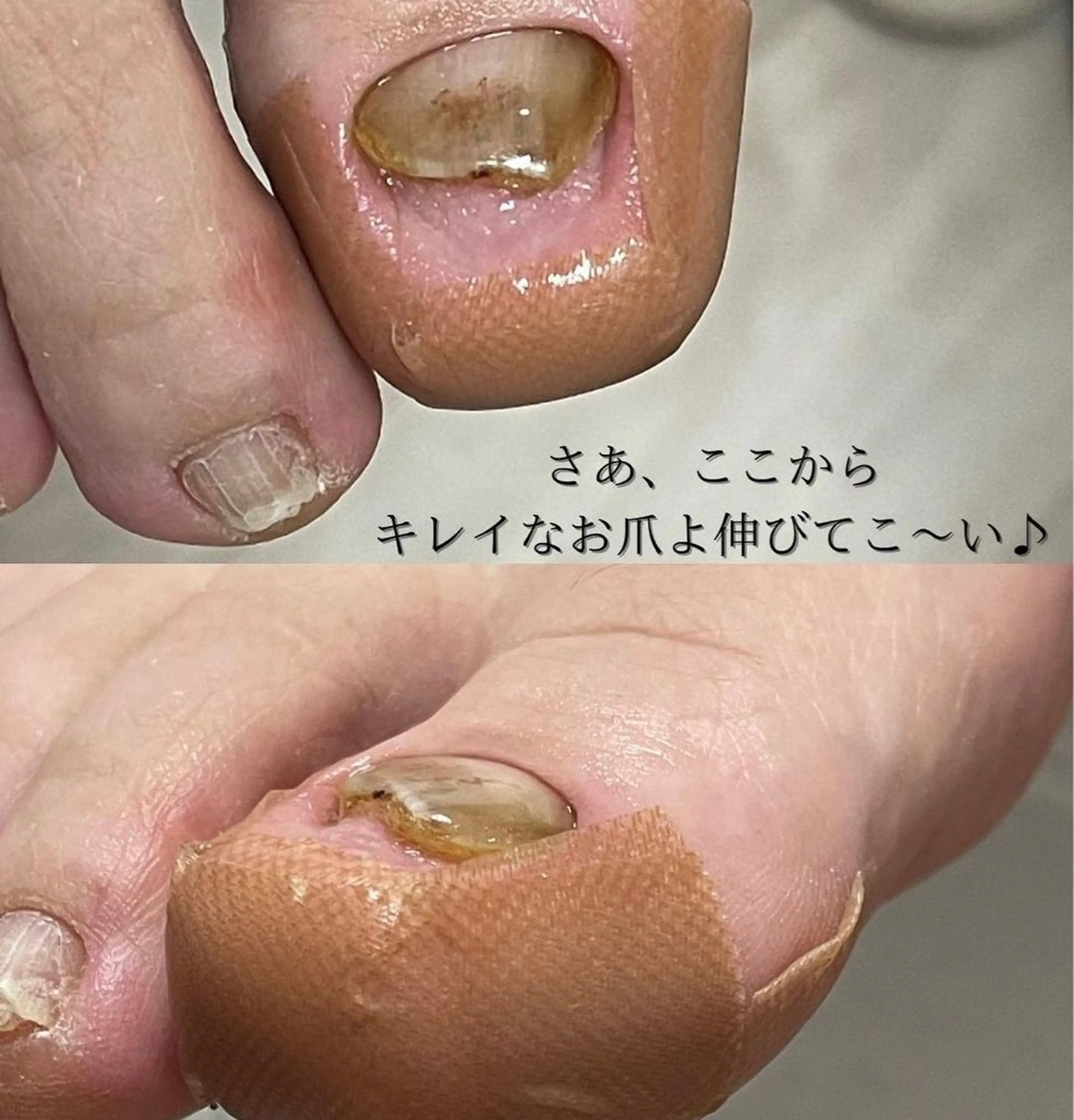 ネイル Belulu ベルルのネイルデザイン