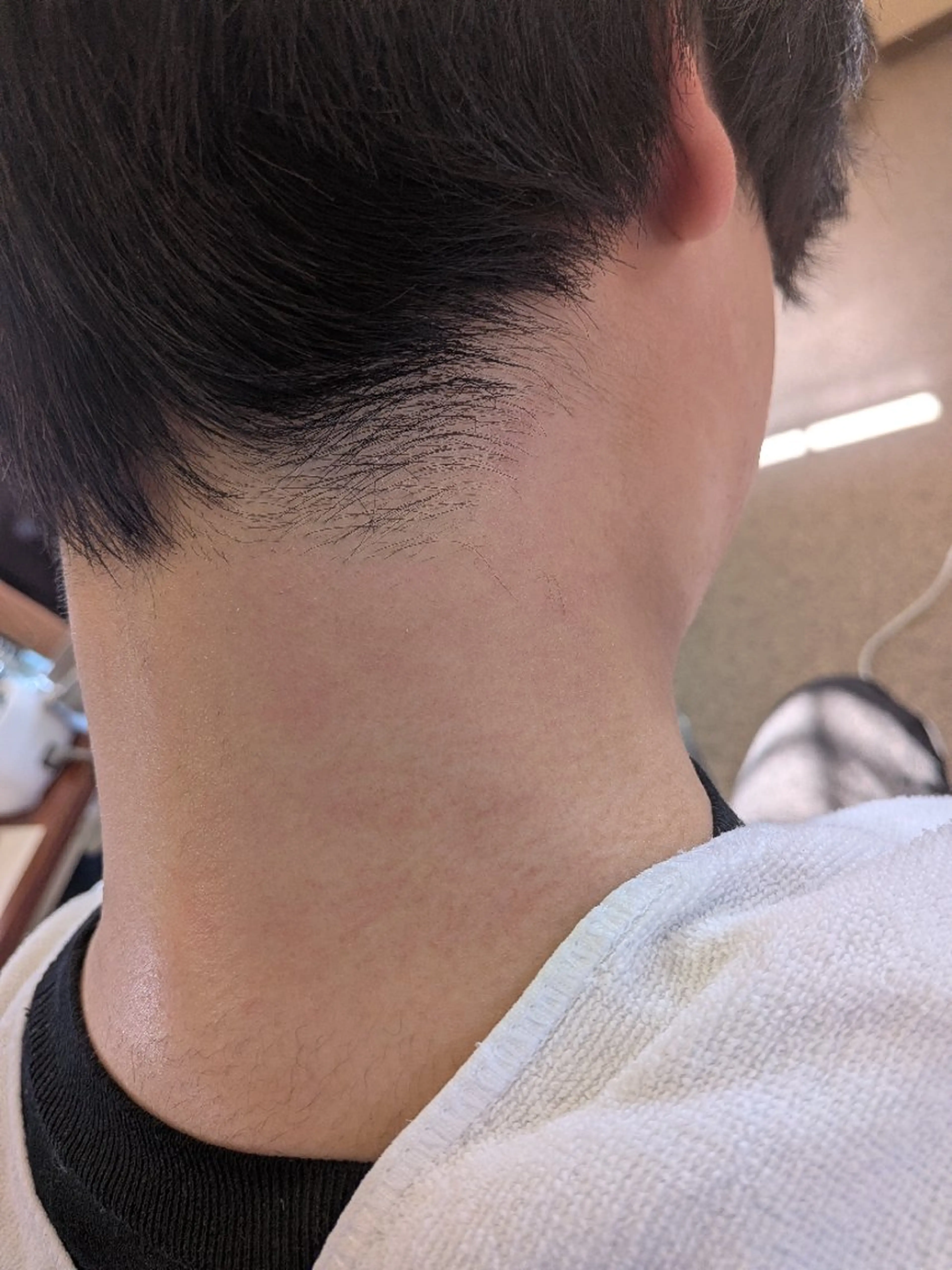 ワックス脱毛(うなじ)の写真