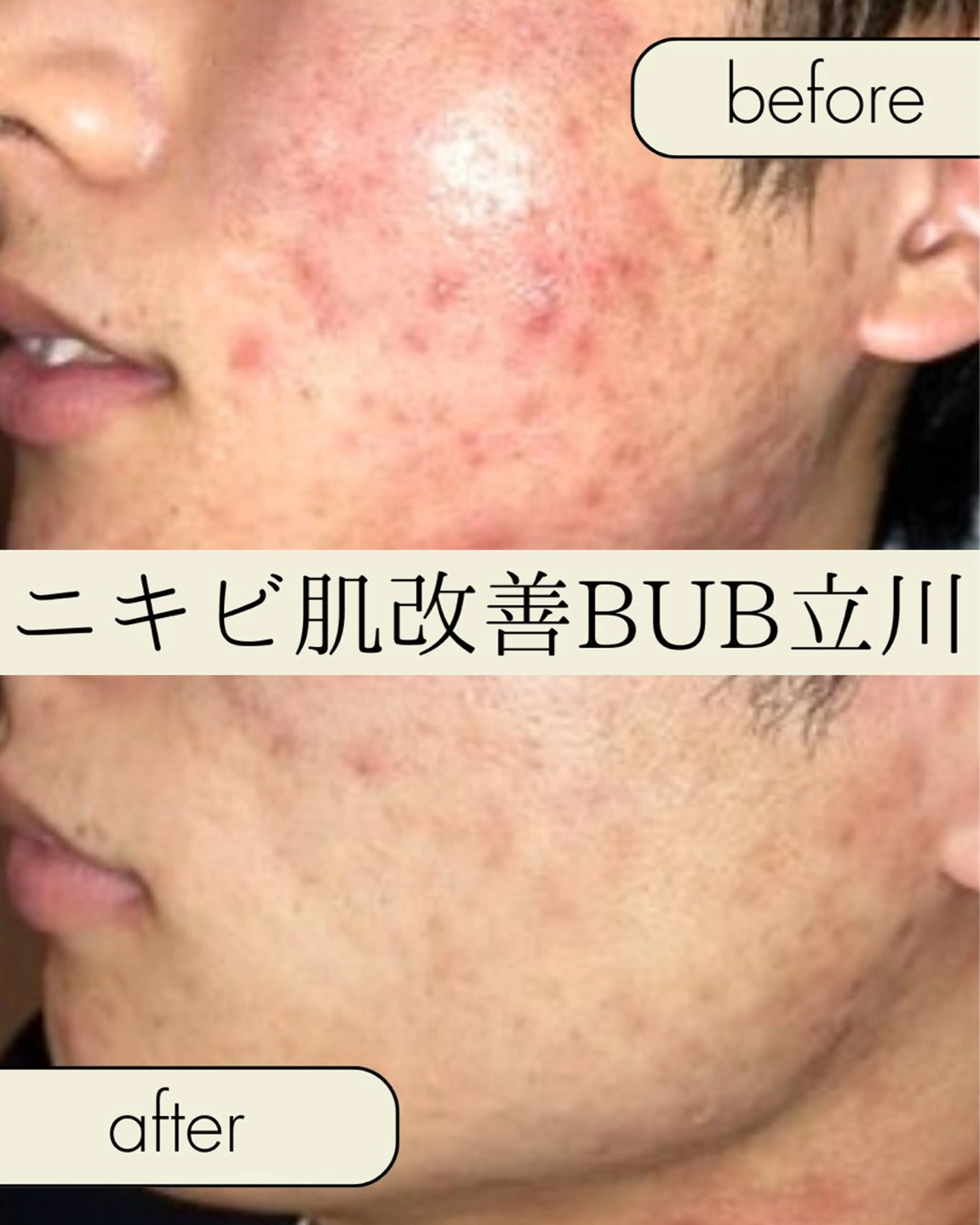 メンズ エステ 【BUB立川】 ゆかのエステ・リラクイメージ