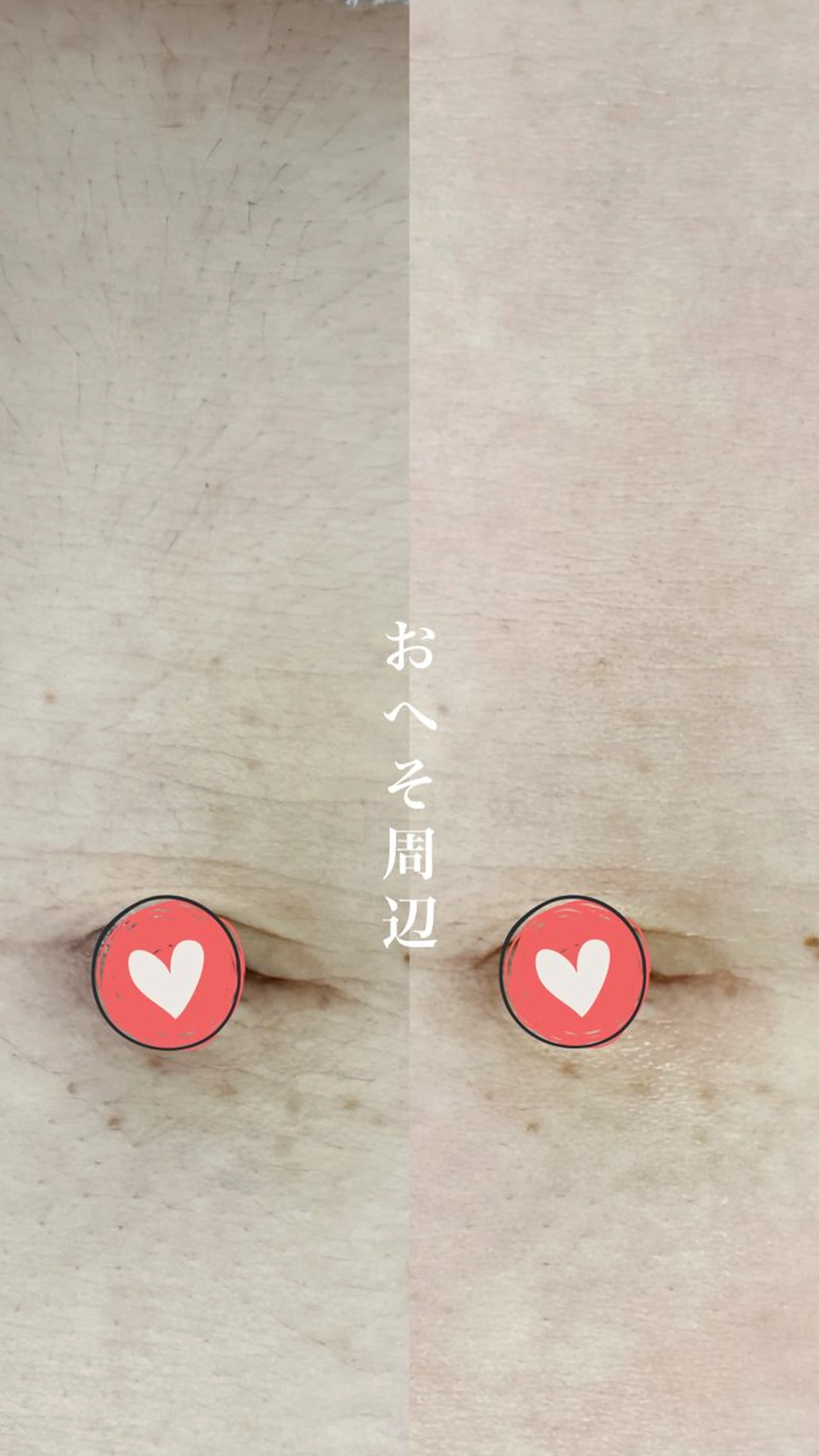 Hitomi シュガーリング豊橋のその他イメージ